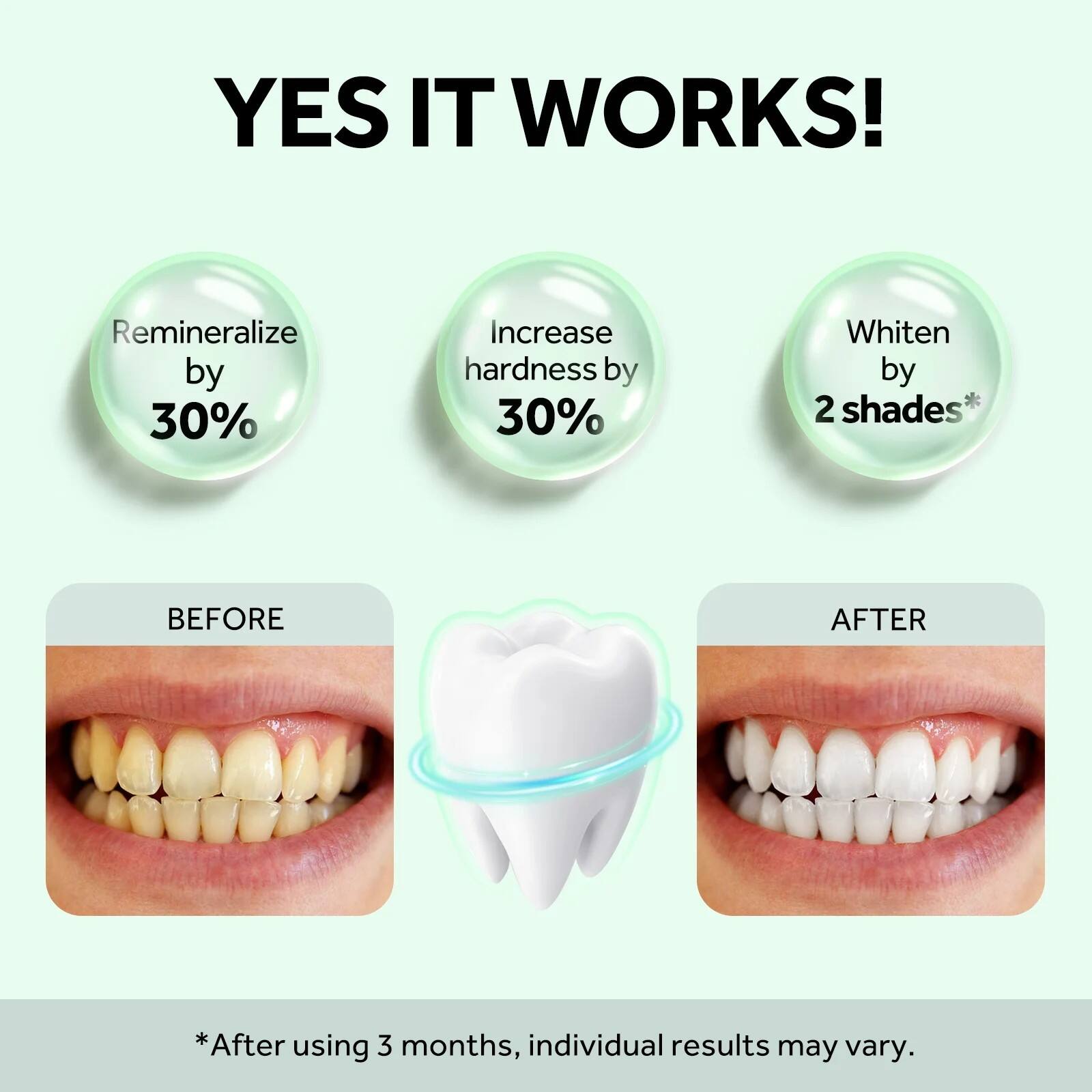 YES IT WORKS!

- Remineralize by 30%
- Increase hardness by 30%
- Whiten by 2 shades*

BEFORE

AFTER

*After using 3 months, individual results may vary.