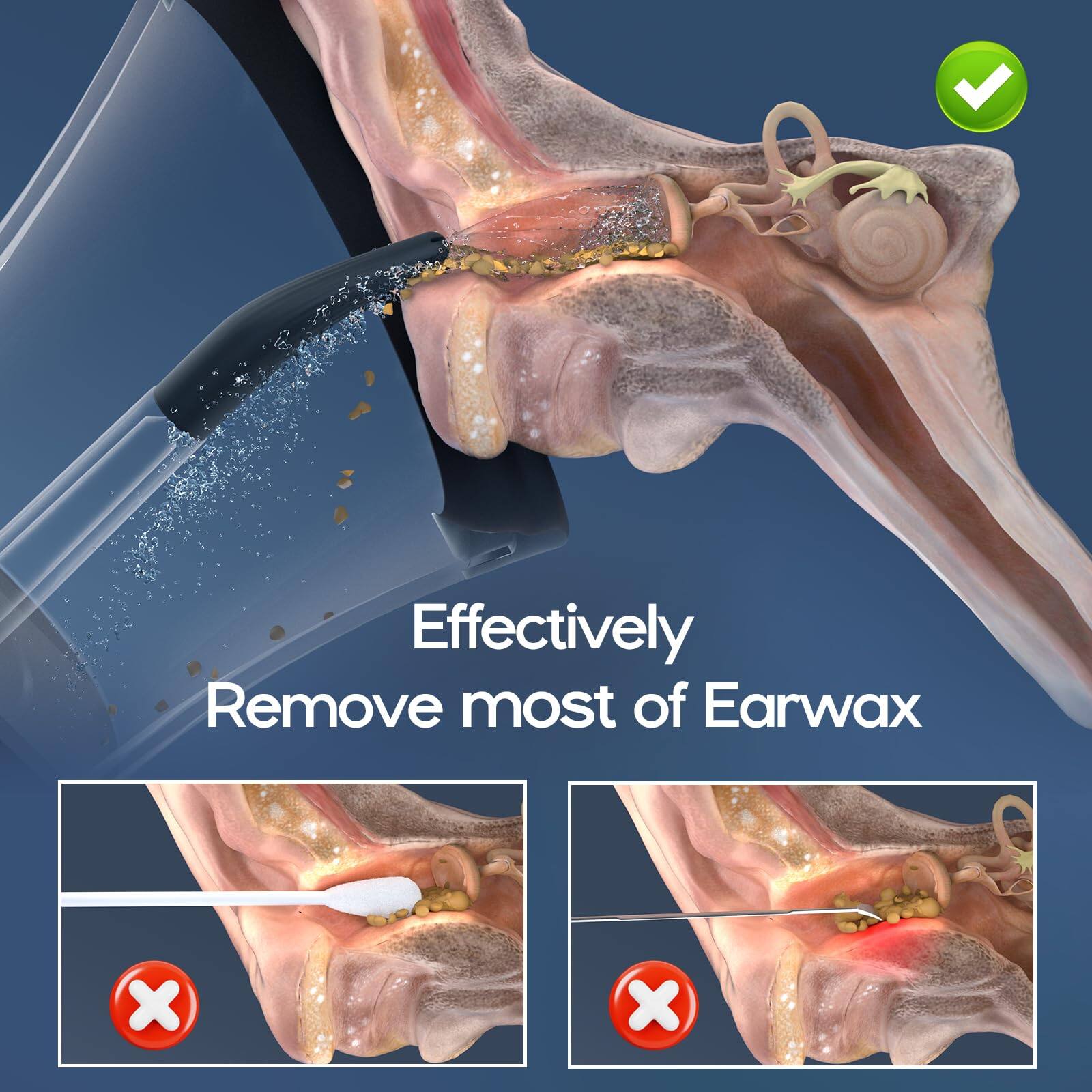 Effectively Remove most of Earwax