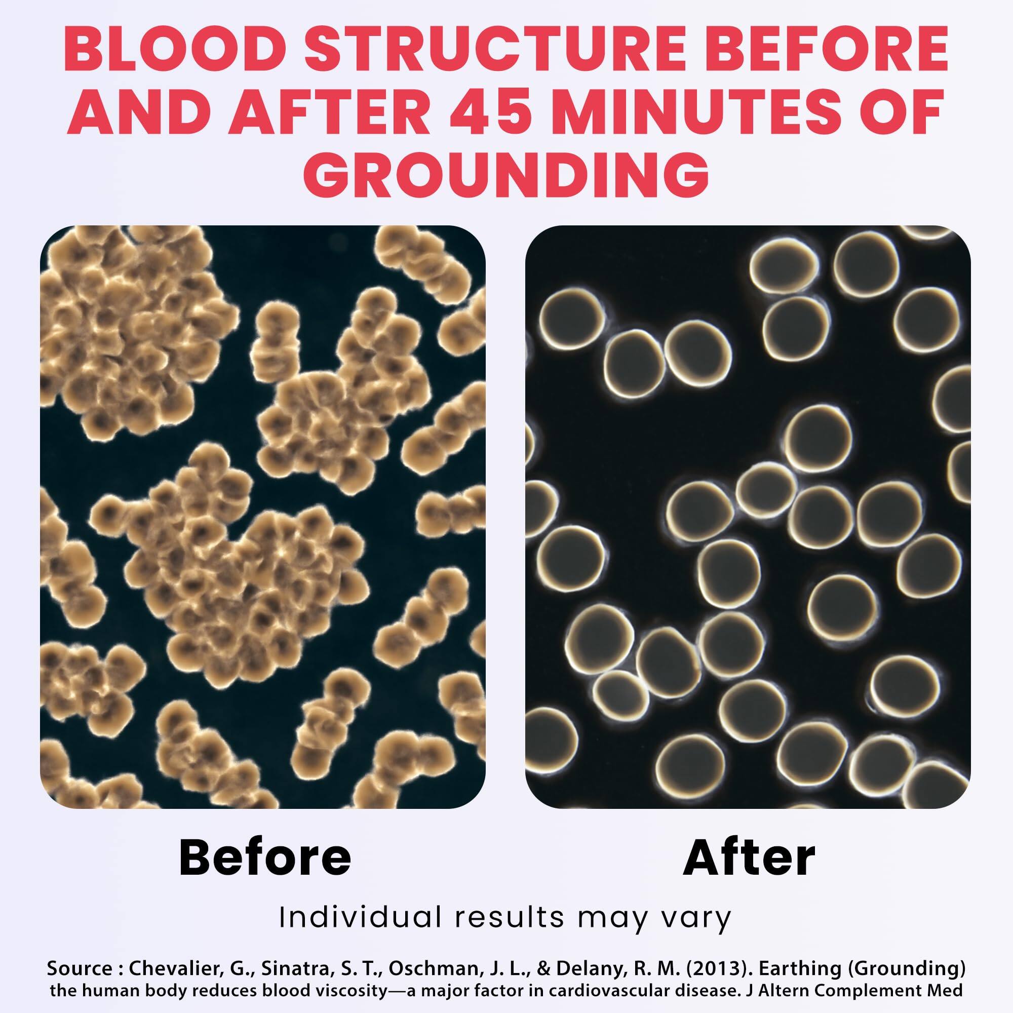 BLOOD STRUCTURE BEFORE AND AFTER 45 MINUTES OF GROUNDING

Before After

Individual results may vary

Source: Chevalier, G., Sinatra, S. T., Oschman, J. L., & Delany, R. M. (2013). Earthing (Grounding) the human body reduces blood viscosity—a major factor in cardiovascular disease. J Altern Complement Med