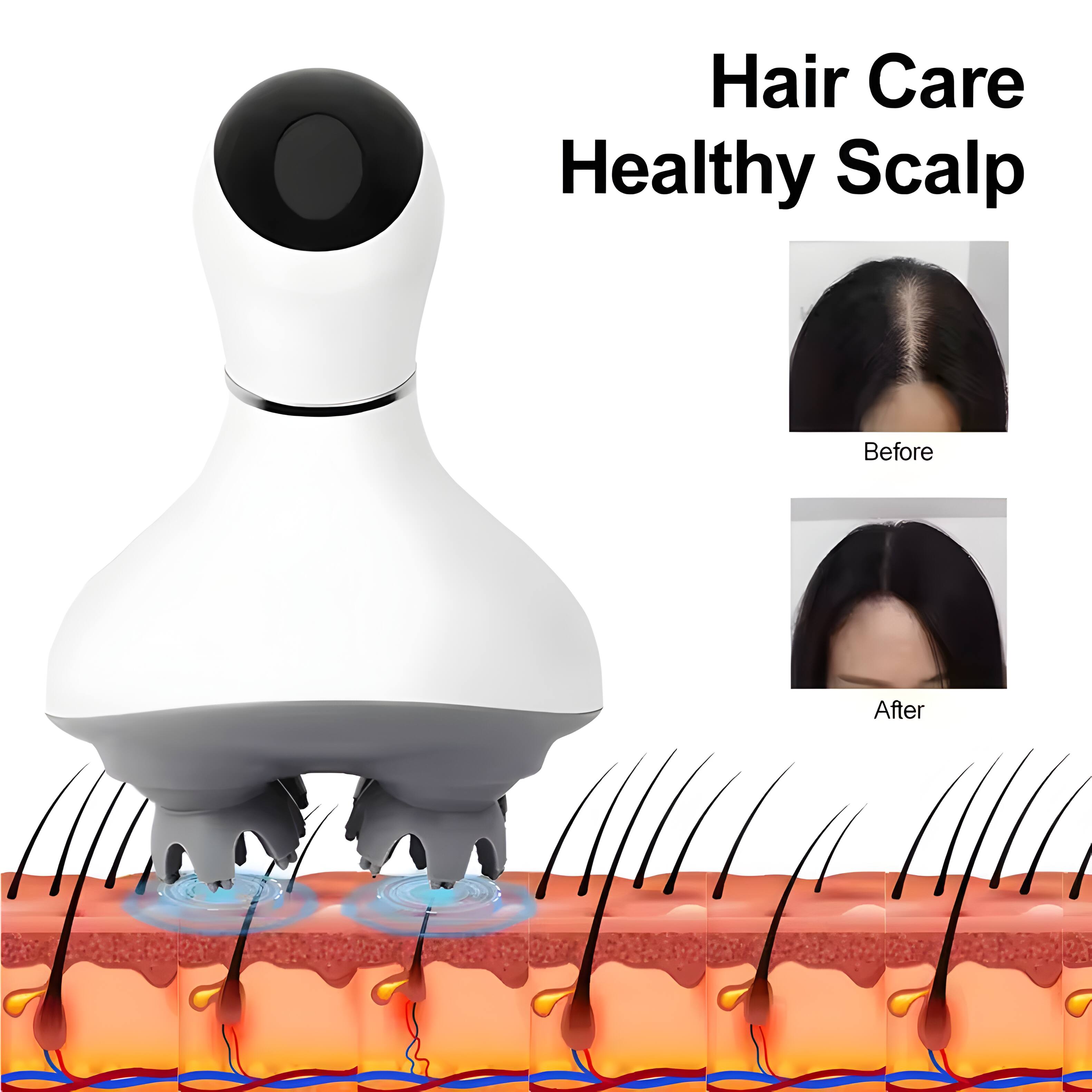 Hair Care Healthy Scalp  
Before  
After
