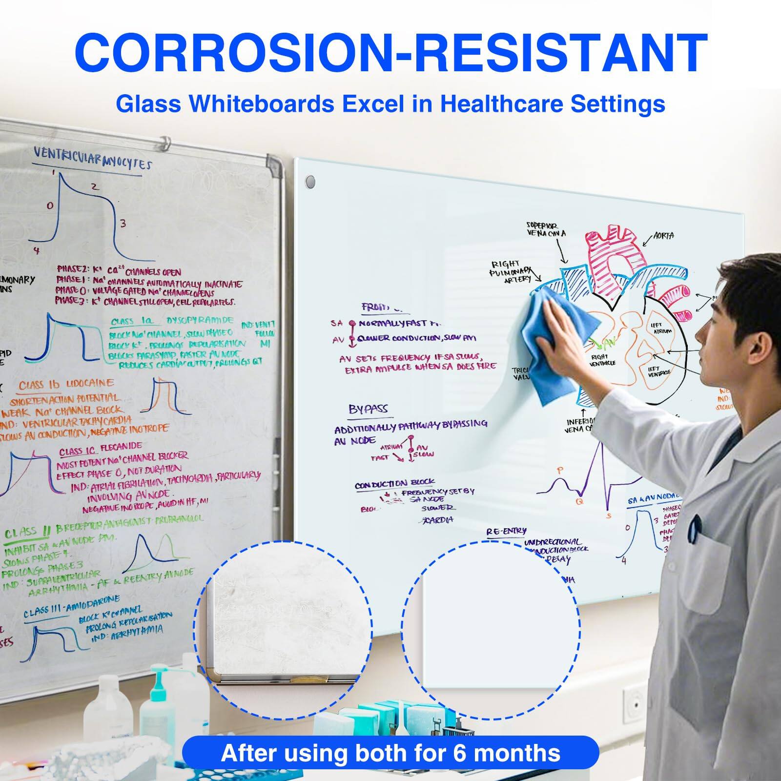 CORROSION-RESISTANT  
Glass Whiteboards Excel in Healthcare Settings

VENTRICULAR MYOCYTES  
1 2 3 4  
PHASE 0: K+ channels open  
PHASE 1: Na+ channels close  
PHASE 2: K+ channels close, Ca2+ channels open  
PHASE 3: K+ channels reopen, cell repolarizes.  

CLASS Ia: DISOPYRAMIDE  
BLOCKS K+ CHANNELS, INCREASES ACTION POTENTIAL DURATION  

CLASS Ib: LIDOCAINE  
BLOCKS Na+ CHANNELS, INCREASES ACTION POTENTIAL DURATION  

CLASS Ic: FLECANIDE  
BLOCKS Na+ CHANNELS, INCREASES ACTION POTENTIAL DURATION  

CLASS II: BREDOLORE ANTAGONIST (FURANTANIL)  
INHIBITS SA NODE, AV NODE, AND PURKINJE FIBERS  

CLASS III: AMIODARONE  
BLOCKS K+ CHANNELS, INCREASES ACTION POTENTIAL DURATION  

CLASS IV: VERAPAMIL  
BLOCKS Ca2+ CHANNELS, INCREASES ACTION POTENTIAL DURATION  

AV SETS FREQUENCY IF SA NODE SLOW, IN