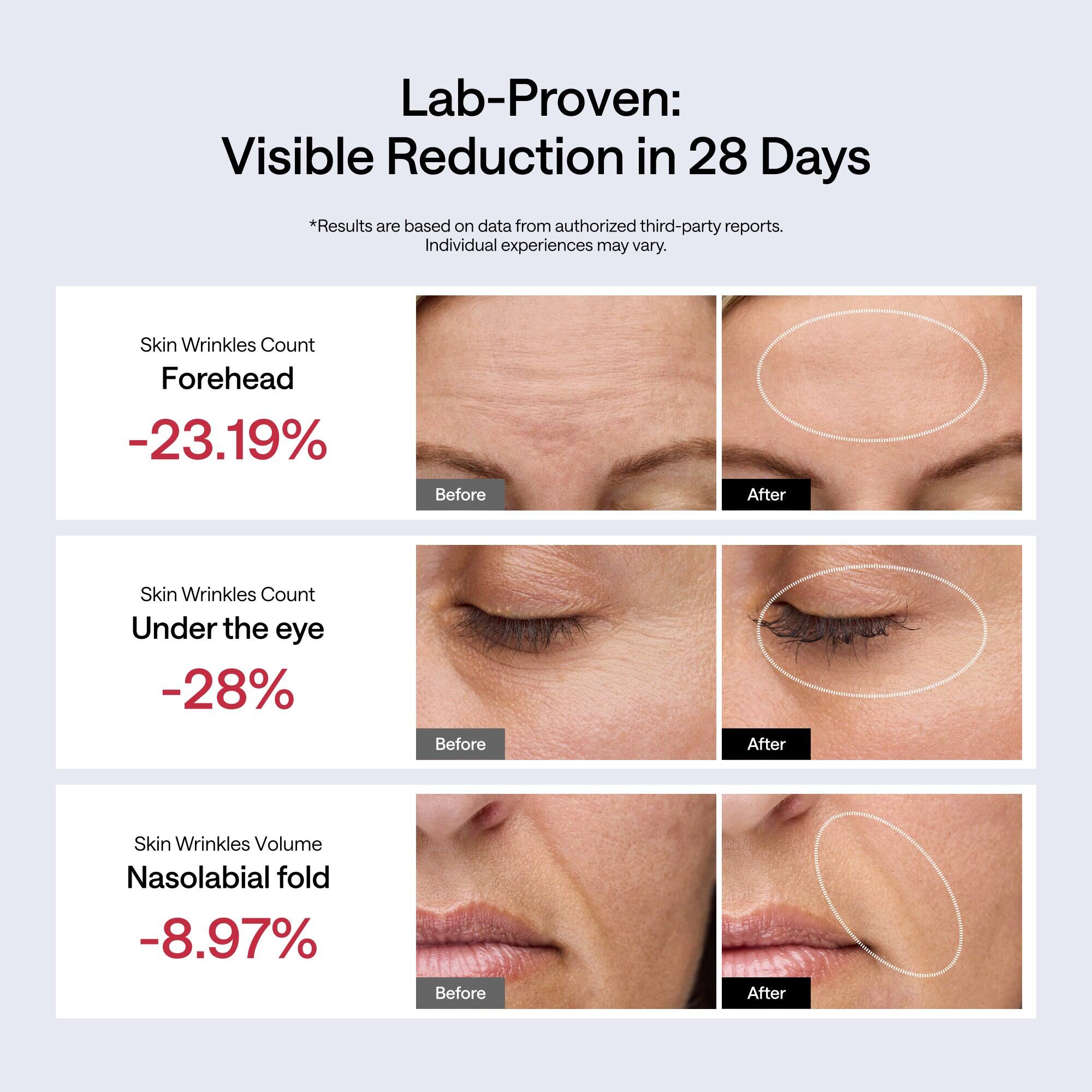 Lab-Proven: Visible Reduction in 28 Days  
*Results are based on data from authorized third-party reports. Individual experiences may vary.  

Skin Wrinkles Count  
Forehead -23.19%  
Before After  

Skin Wrinkles Count  
Under the eye -28%  
Before After  

Skin Wrinkles Volume  
Nasolabial fold -8.97%  
Before After