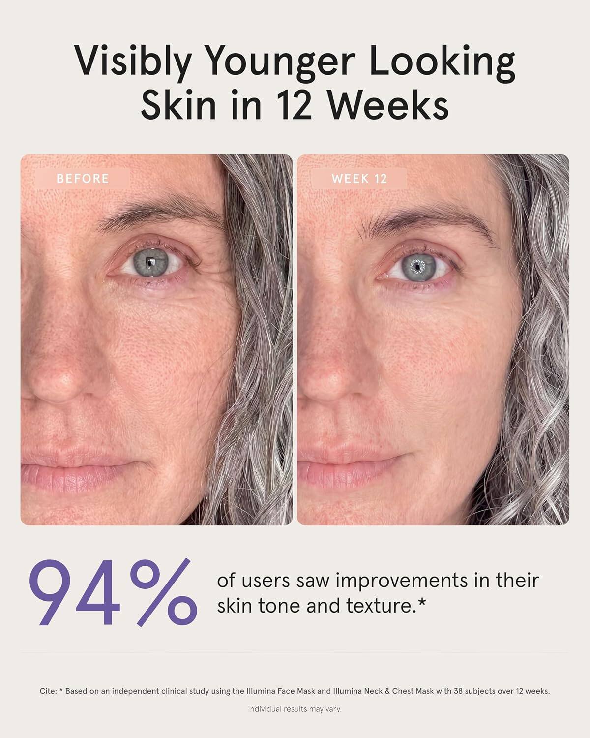 Visibly Younger Looking Skin in 12 Weeks

BEFORE
WEEK 12

94% of users saw improvements in their skin tone and texture.*

Cite: Based on an independent clinical study using the Illumina Face Mask and Illumina Neck & Chest Mask with 38 subjects over 12 weeks.
Individual results may vary.