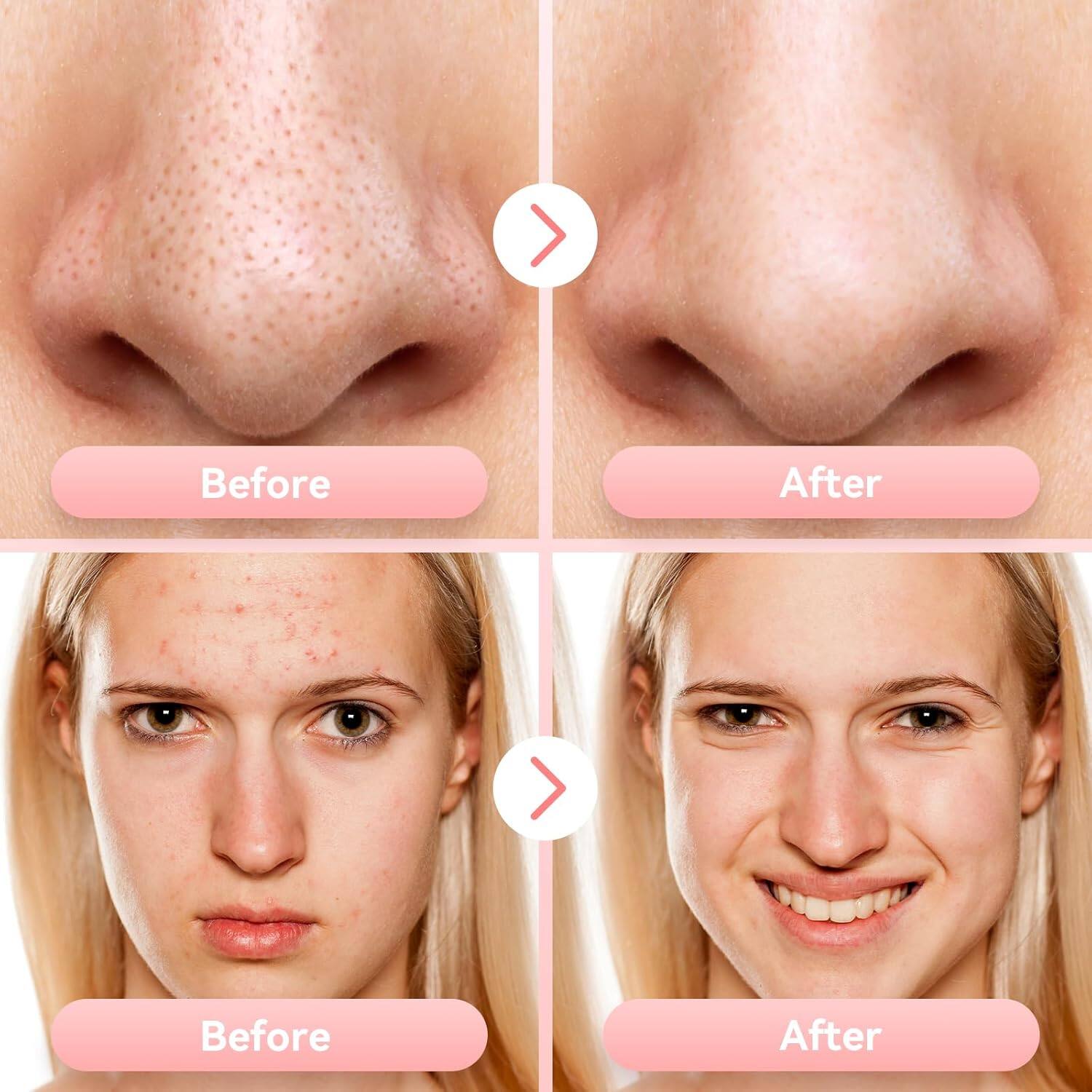 Before After  
Before After
