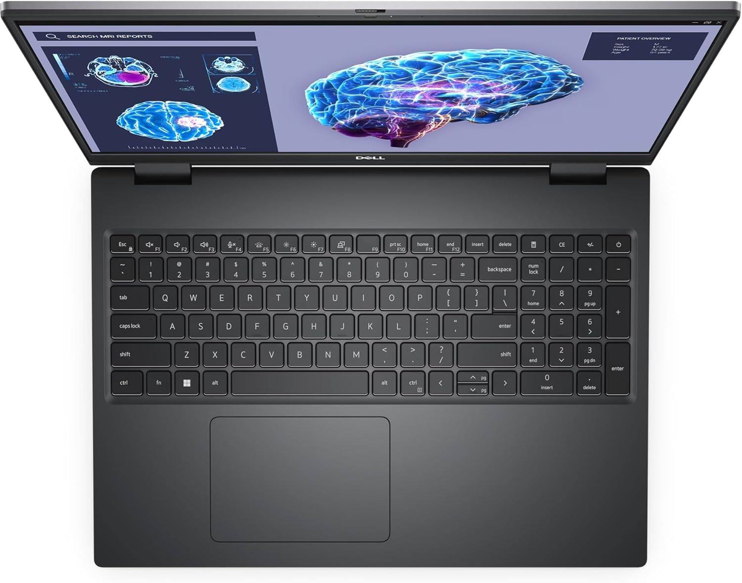 SEARCH MRI REPORTS

F1 F2 F3 F4 F5 F6 F7 F8 F9 F10 F11 F12

Esc 1 2 3 4 5 6 7 8 9 0 - = Backspace

Tab Q W E R T Y U I O P [ ] \

Caps Lock A S D F G H J K L ; '

Shift Z X C V B N M , . /

Ctrl Fn Alt