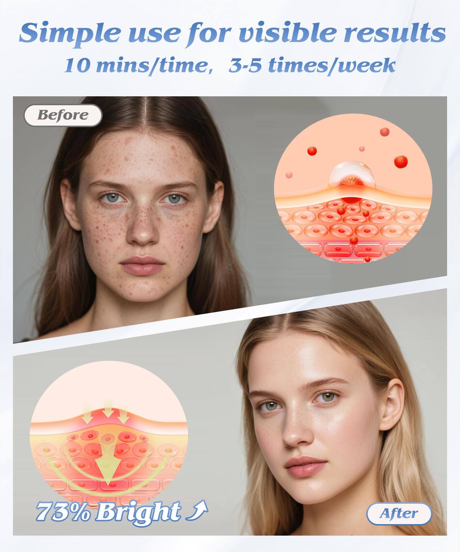 Simple use for visible results  
10 mins/time, 3-5 times/week  

Before  

73% Bright ↑  

After