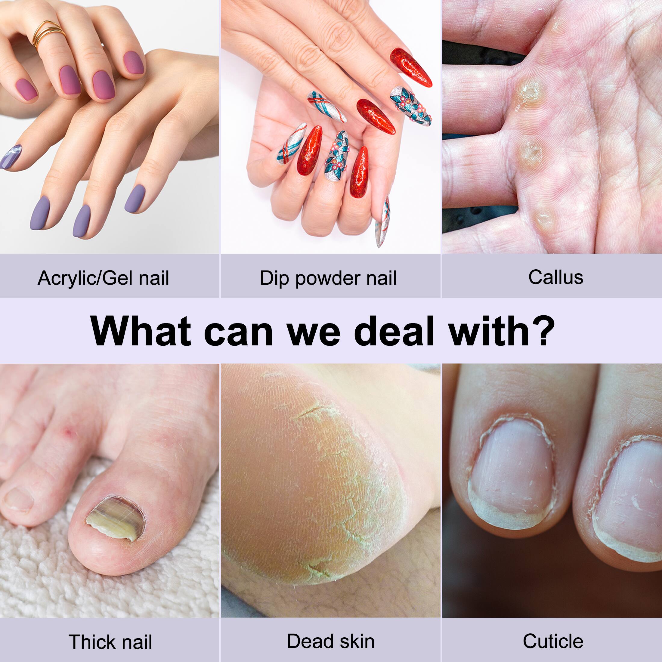 Acrylic/Gel nail  
Dip powder nail  
Callus  

What can we deal with?  

Thick nail  
Dead skin  
Cuticle