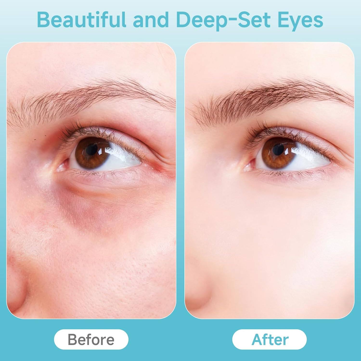 Beautiful and Deep-Set Eyes

Before

After