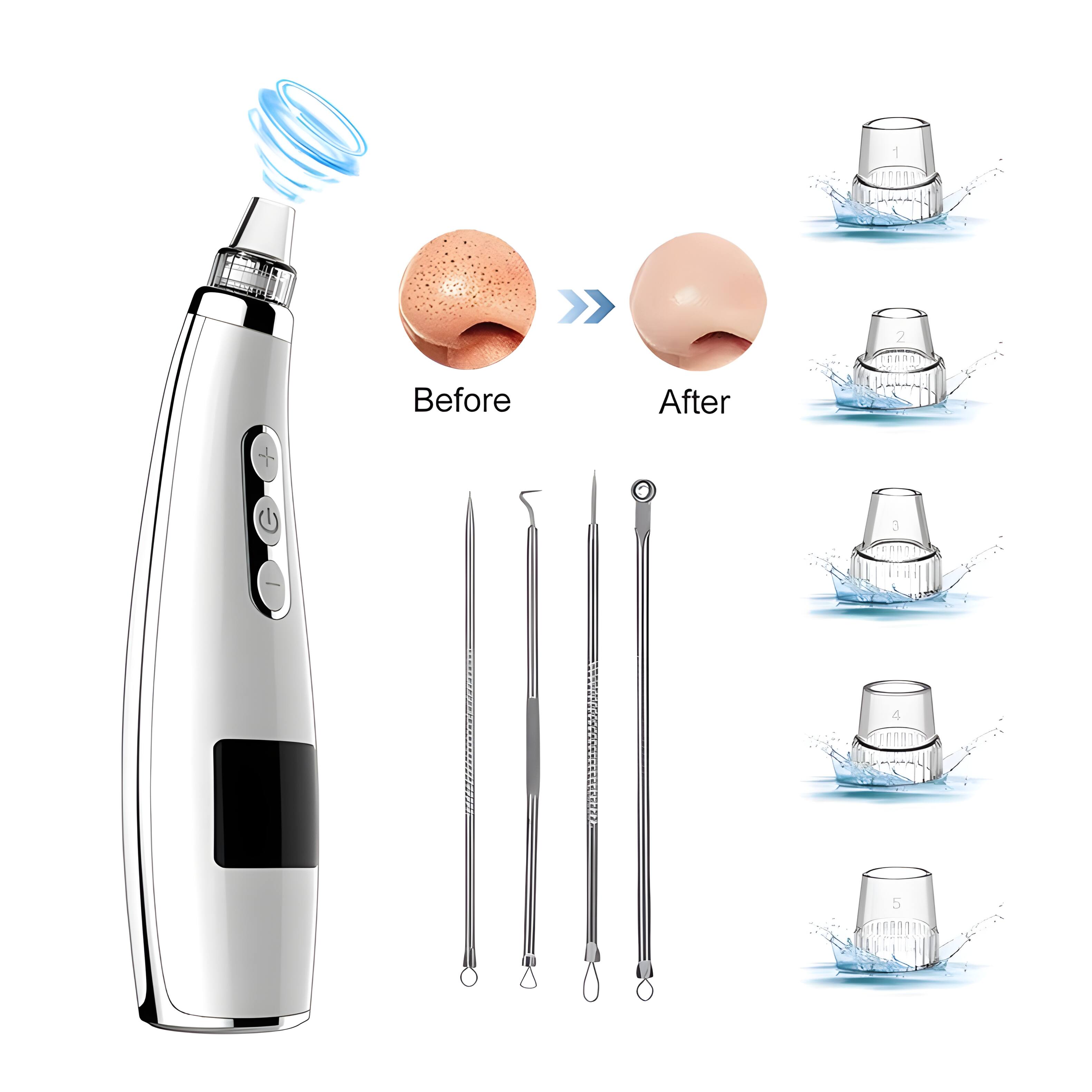 2 Before After (4 5