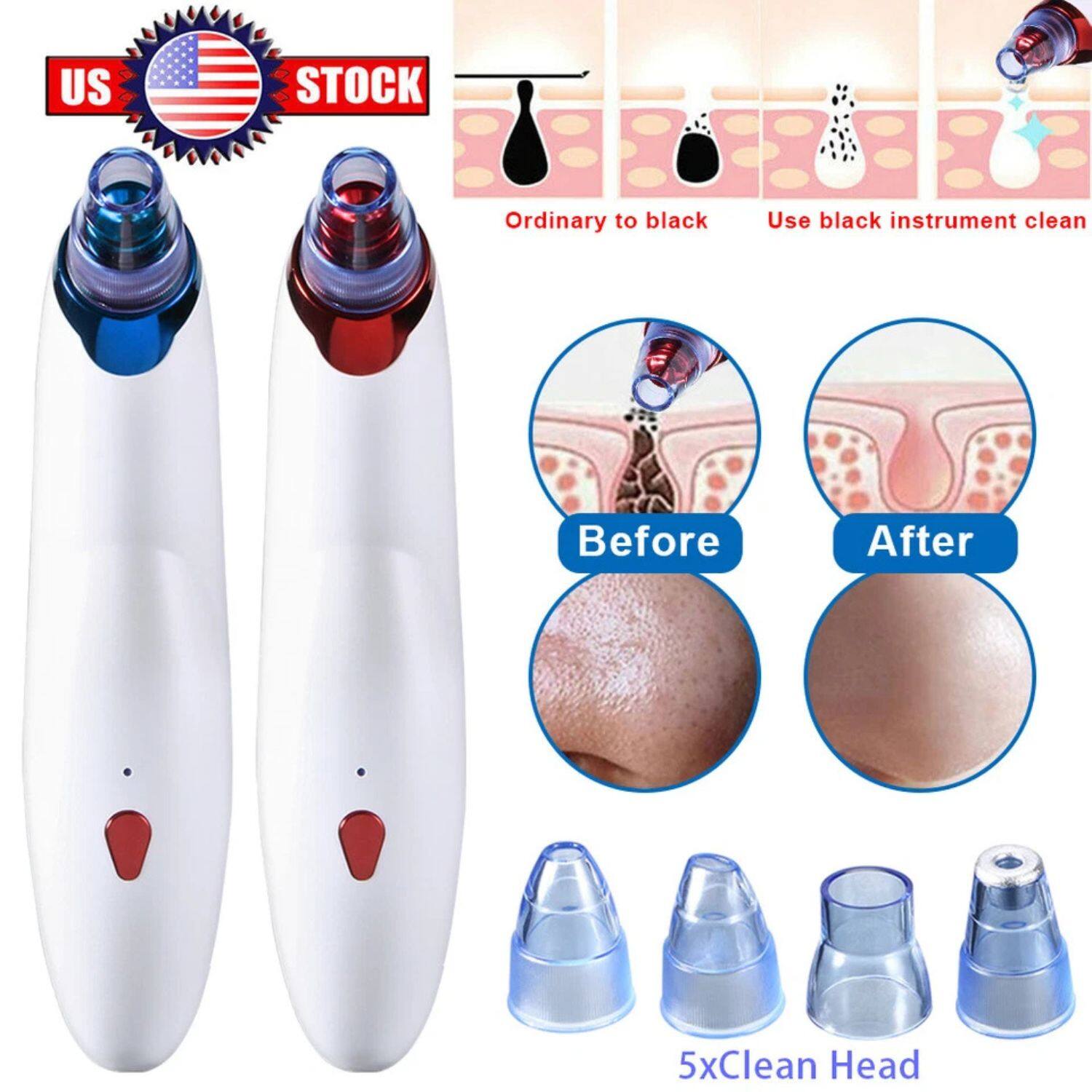 US STOCK

Ordinary to black  
Use black instrument clean

Before  
After

5x Clean Head