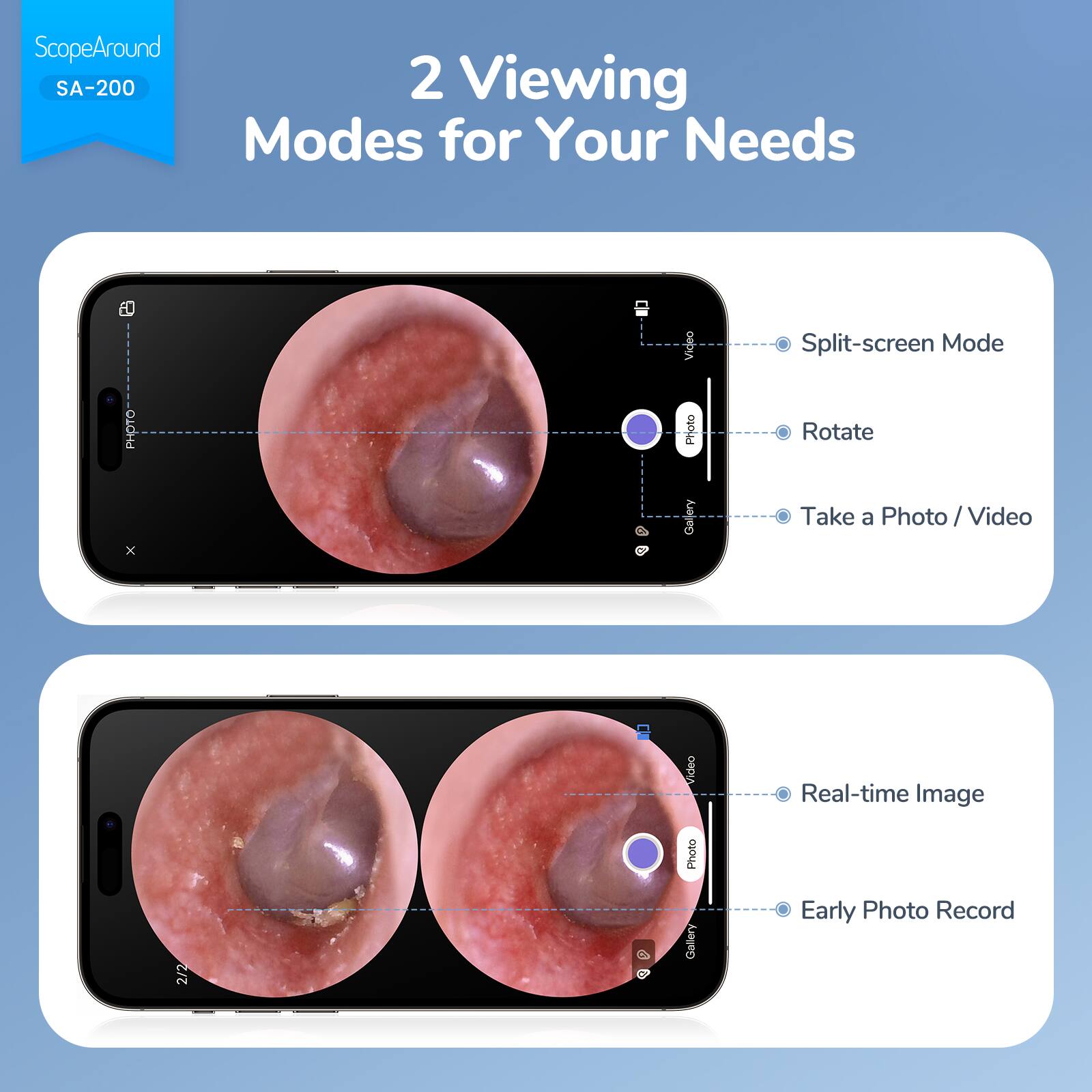 ScopeAround SA-200

2 Viewing Modes for Your Needs

- Split-screen Mode
- Rotate
- Take a Photo / Video
- Real-time Image
- Early Photo Record