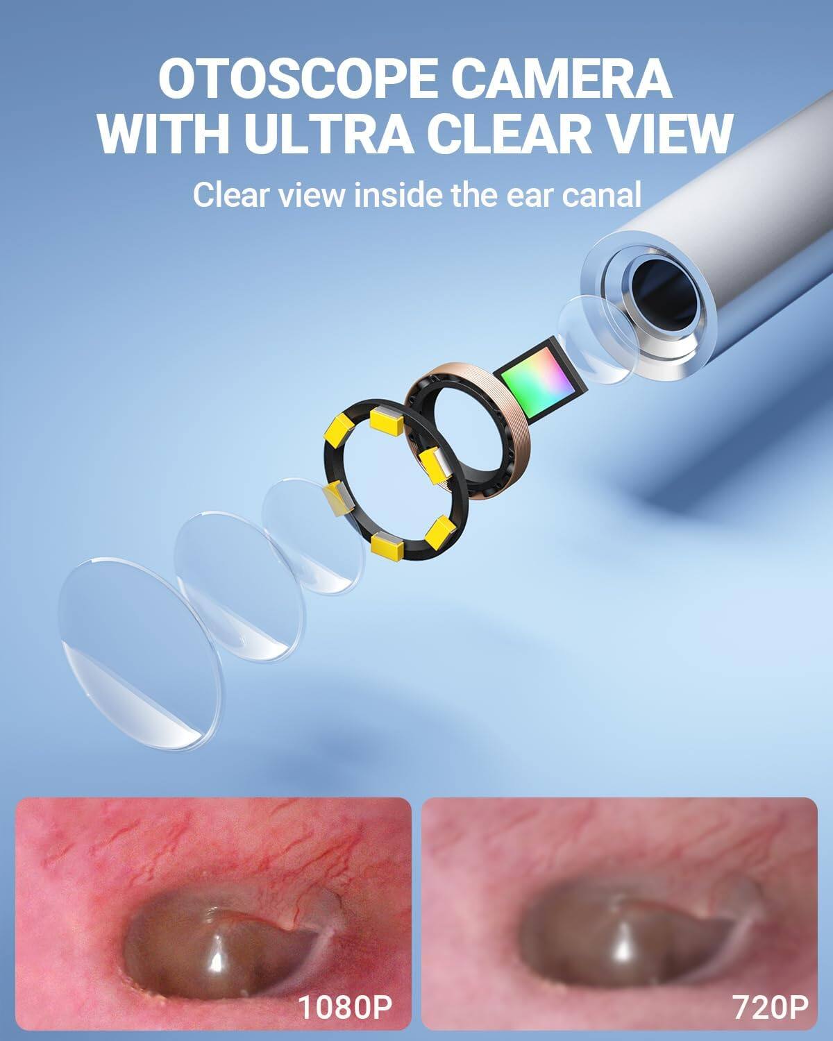 OTOSCOPE CAMERA WITH ULTRA CLEAR VIEW  
Clear view inside the ear canal  
1080P  
720P