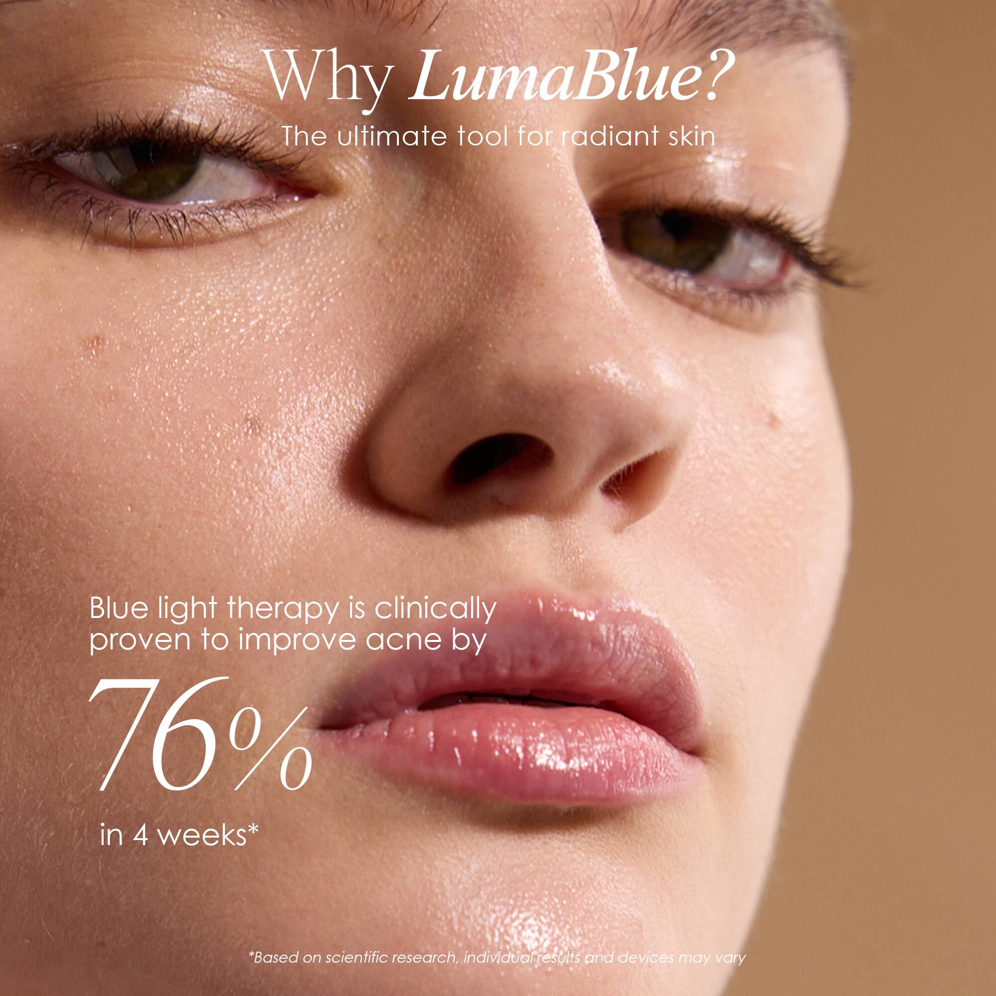 Why LumaBlue?  
The ultimate tool for radiant skin  

Blue light therapy is clinically proven to improve acne by 76% in 4 weeks*  

*Based on scientific research, individual results and devices may vary