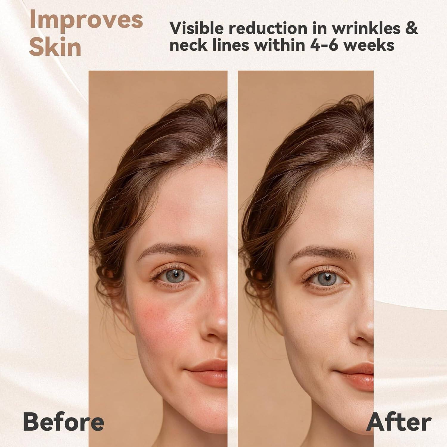 Improves Skin  
Visible reduction in wrinkles & neck lines within 4-6 weeks  

Before  
After