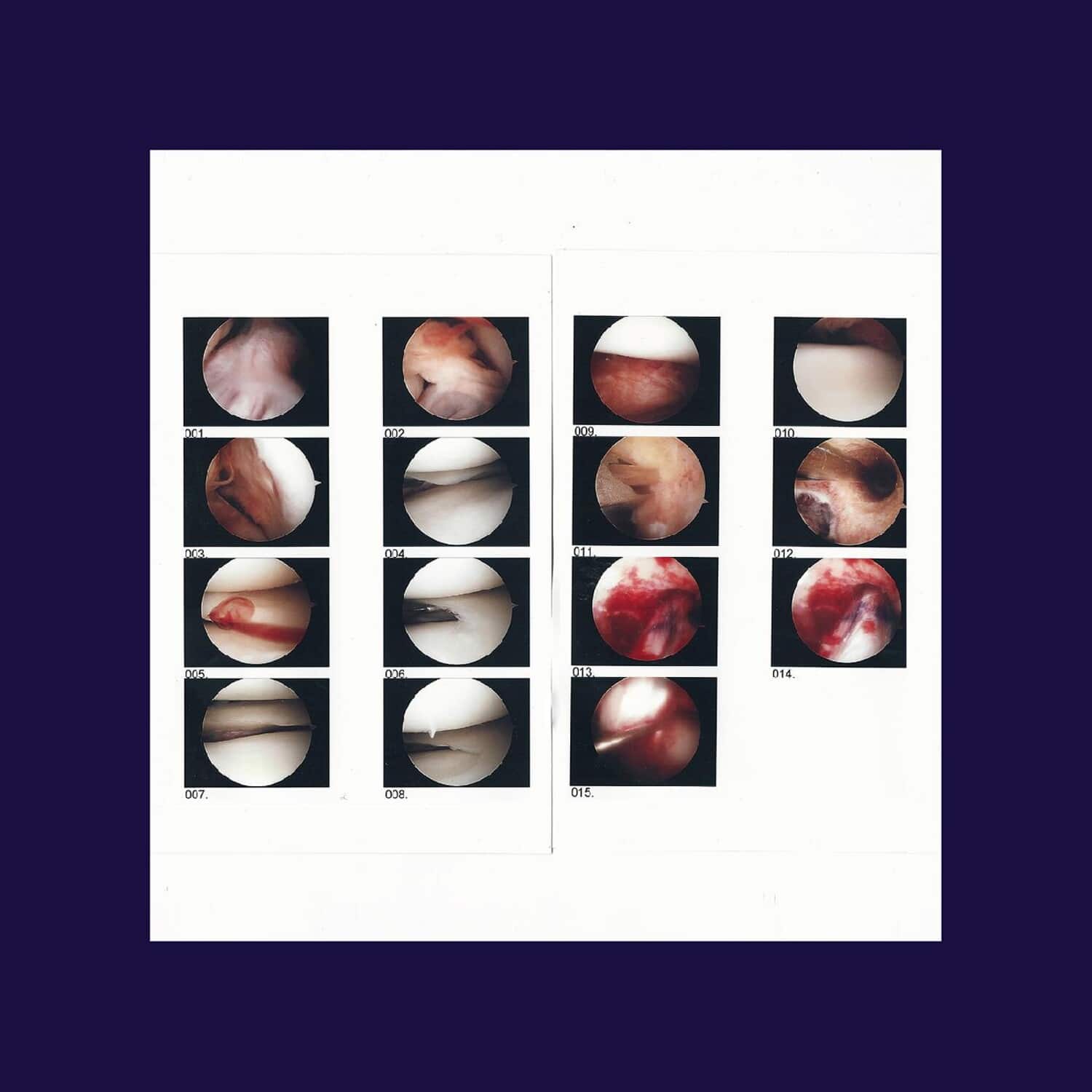 Cradle - Laughing In My Sleep   - COMPACT DISCS [CD] price history on PriceWatchPro