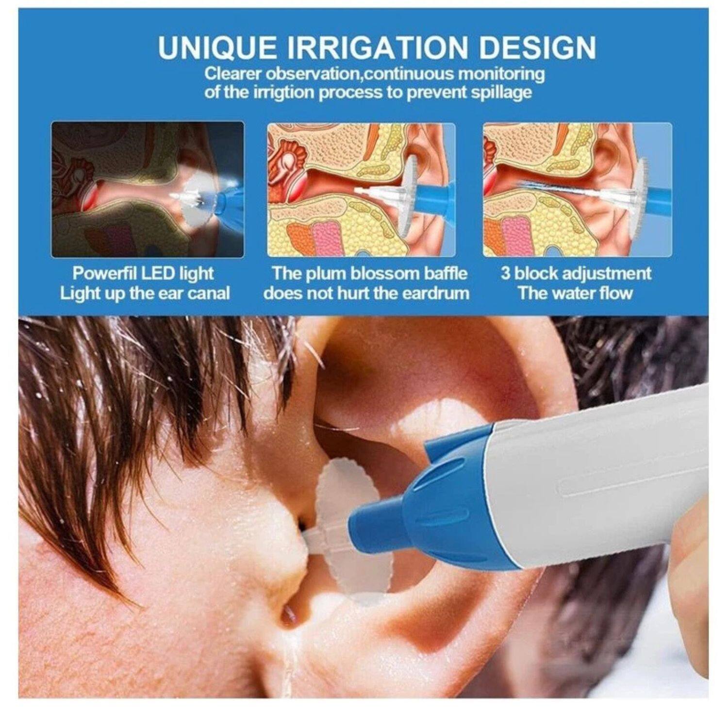 UNIQUE IRRIGATION DESIGN  
Clearer observation, continuous monitoring of the irrigation process to prevent spillage  

- Powerful LED light  
  Light up the ear canal  

- The plum blossom baffle  
  Does not hurt the eardrum  

- 3 block adjustment  
  The water flow