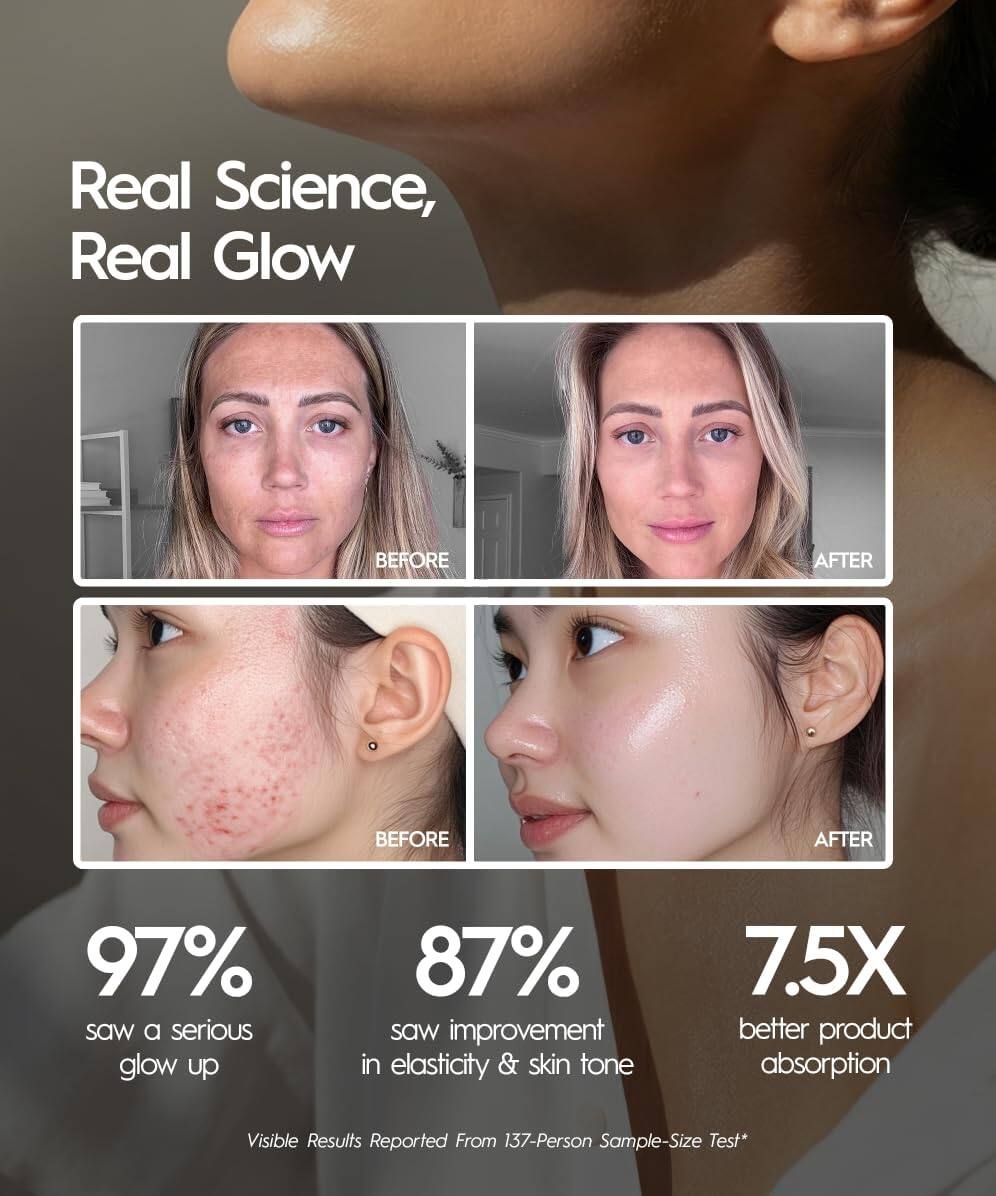 Real Science, Real Glow

BEFORE AFTER  
BEFORE AFTER

97% saw a serious glow up  
87% saw improvement in elasticity & skin tone  
7.5X better product absorption  

Visible Results Reported From 137-Person Sample-Size Test*