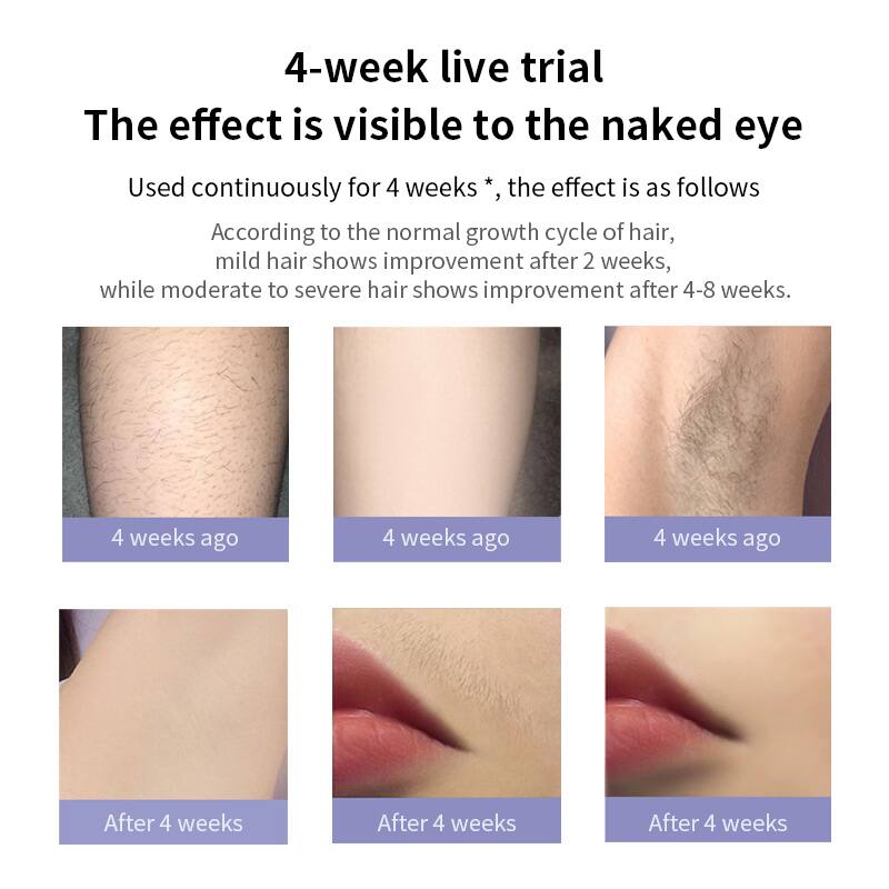 4-week live trial  
The effect is visible to the naked eye  

Used continuously for 4 weeks*, the effect is as follows  

According to the normal growth cycle of hair, mild hair shows improvement after 2 weeks, while moderate to severe hair shows improvement after 4-8 weeks.  

4 weeks ago  
4 weeks ago  
4 weeks ago  

After 4 weeks  
After 4 weeks  
After 4 weeks