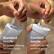 Standard nozzle for power cleaning between teeth
Comfort nozzle with soft tip for sensitive gums