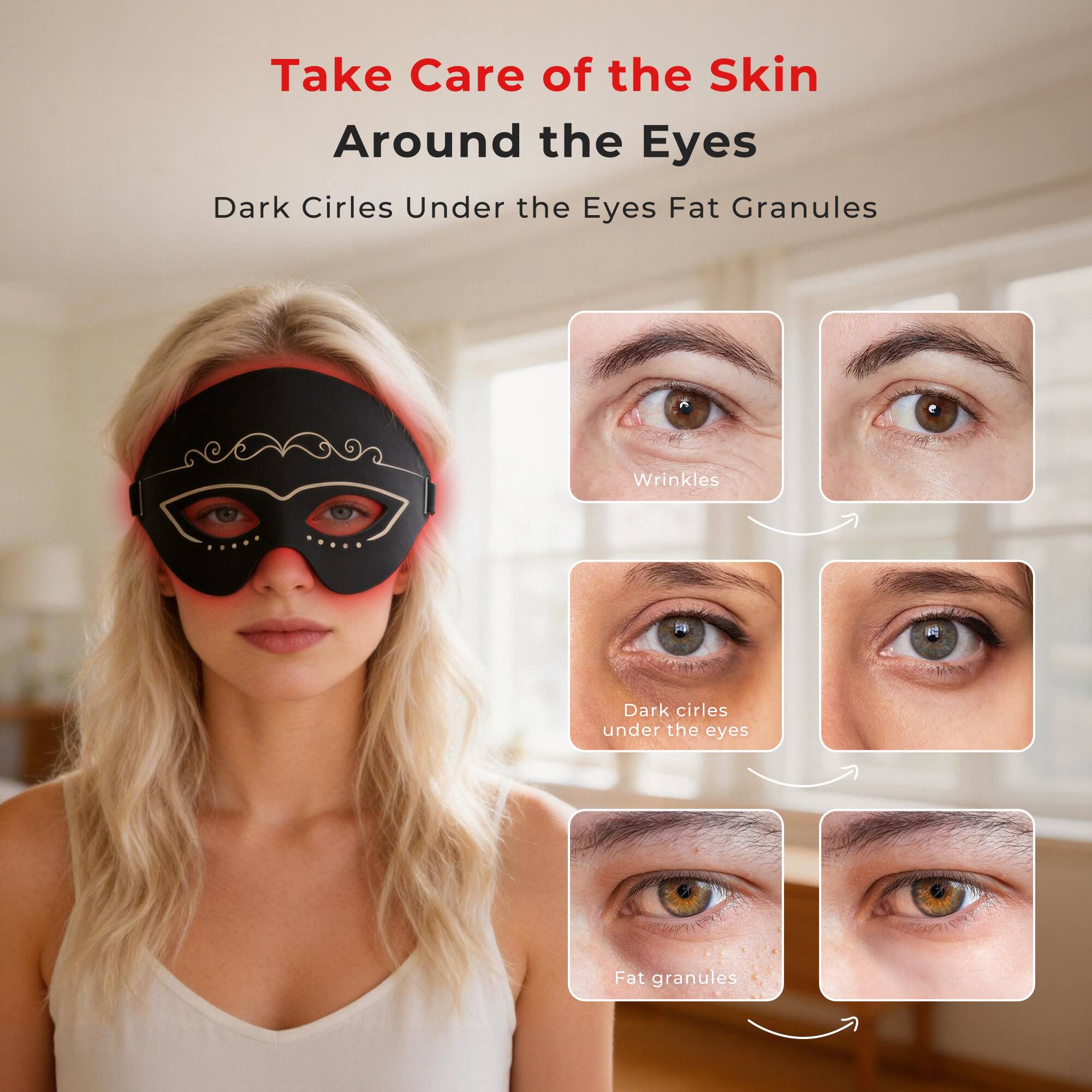 Take Care of the Skin Around the Eyes

Dark Circles Under the Eyes Fat Granules

- Wrinkles
- Dark circles under the eyes
- Fat granules