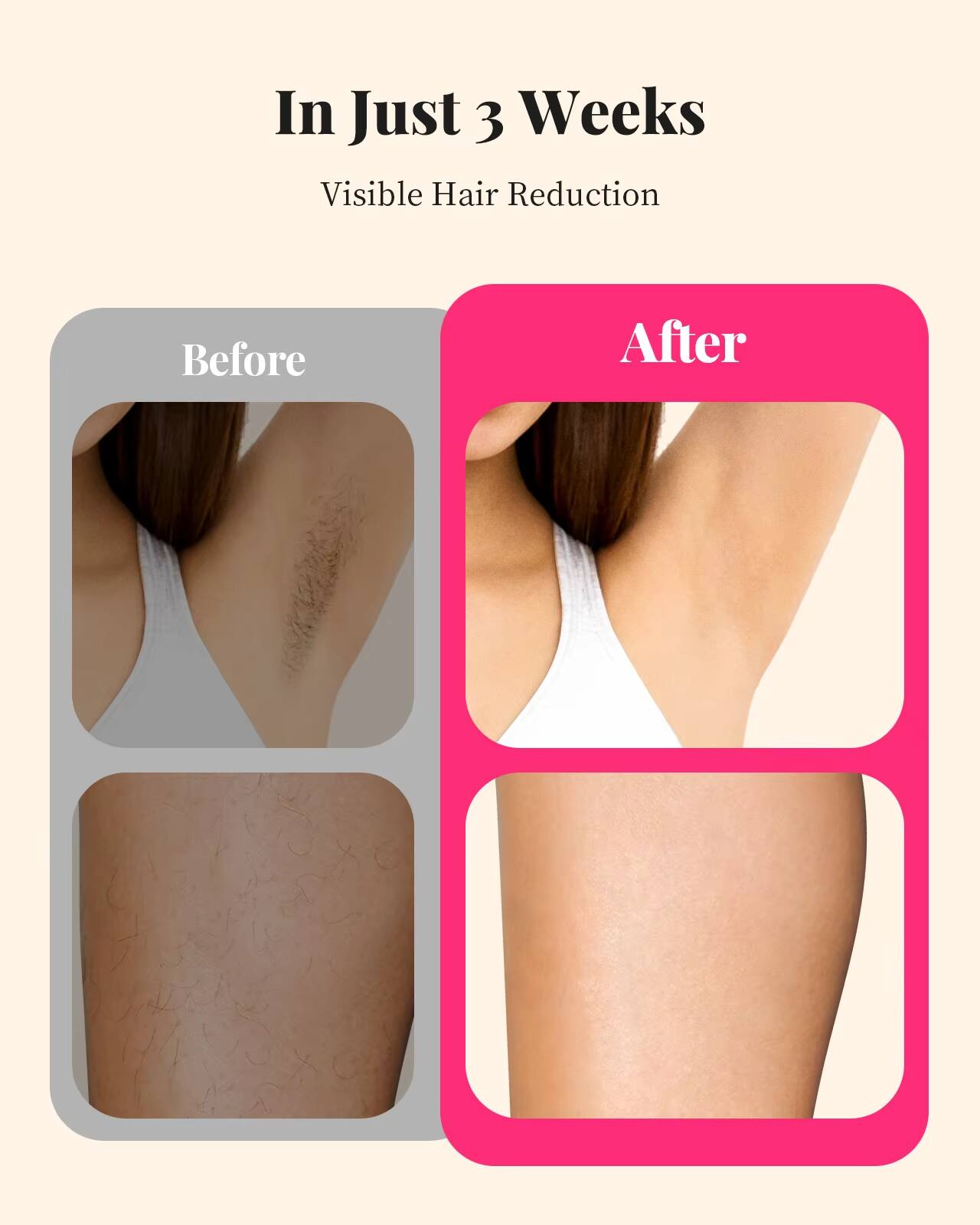 In Just 3 Weeks  
Visible Hair Reduction  

Before  
After