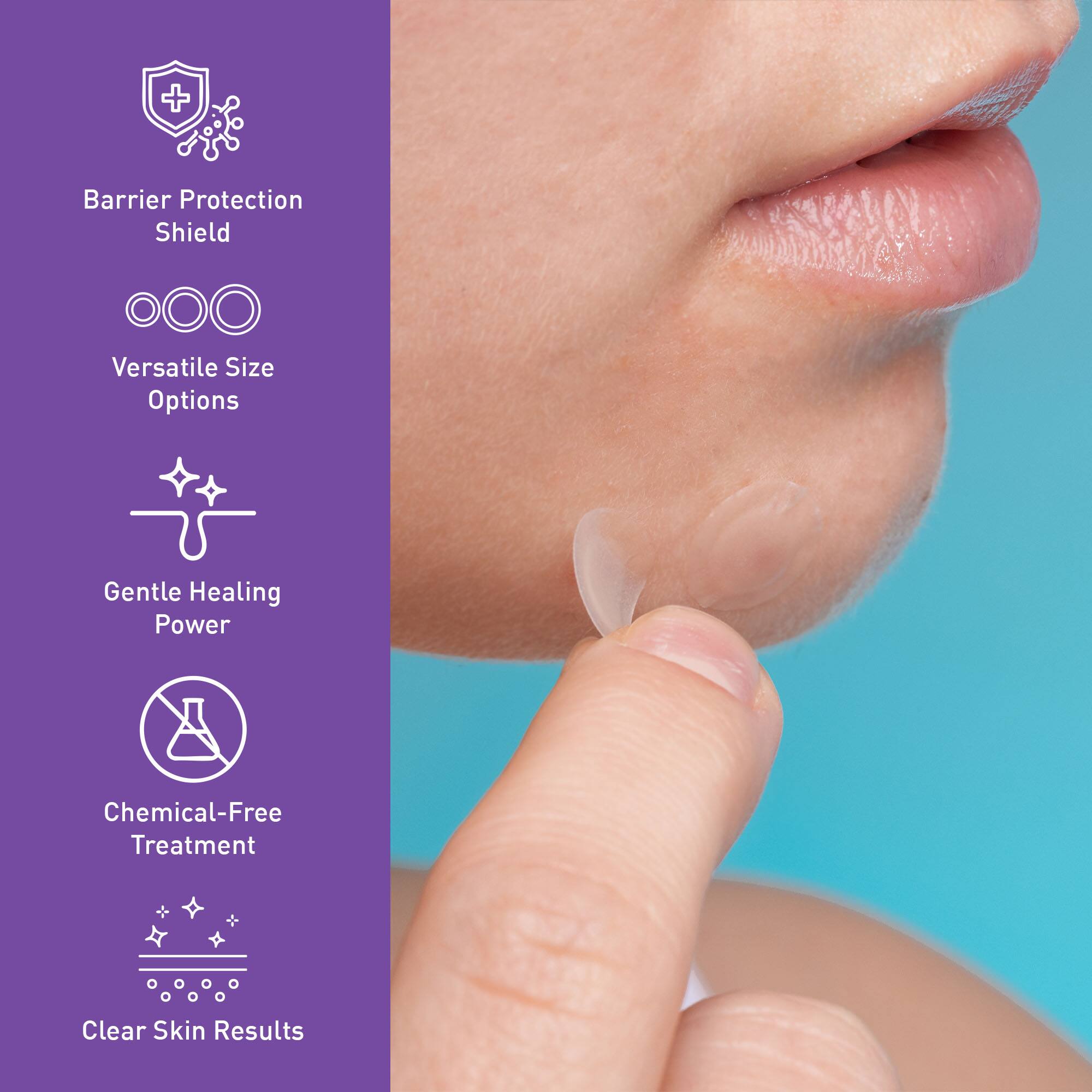 - Barrier Protection Shield
- Versatile Size Options
- Gentle Healing Power
- Chemical-Free Treatment
- Clear Skin Results