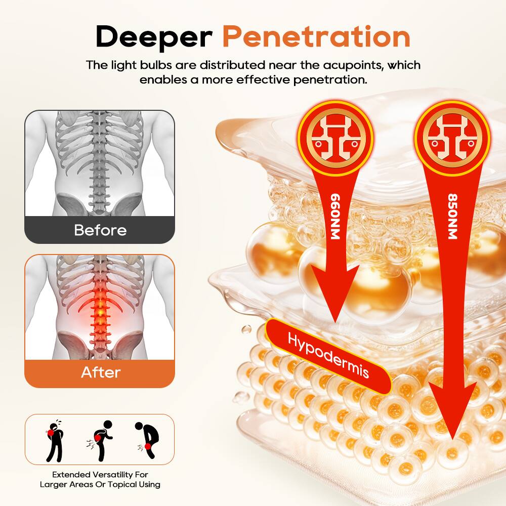 Deeper Penetration  
The light bulbs are distributed near the acupoints, which enables a more effective penetration.  

Before  
660NM  
850NM  
After  

Hypodermis  

Extended Versatility For Larger Areas Or Topical Using