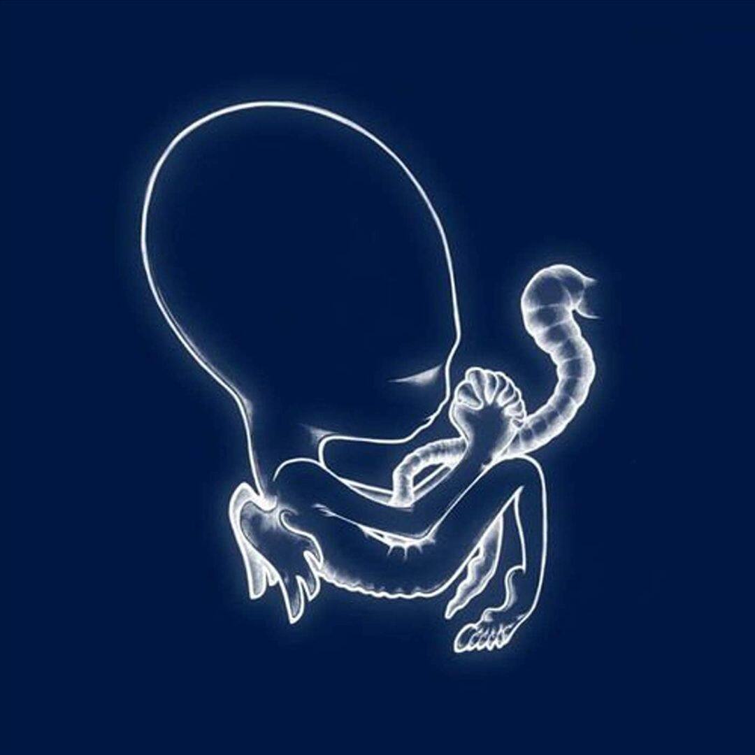 Ágætis Byrjun [LP] [VINYL]