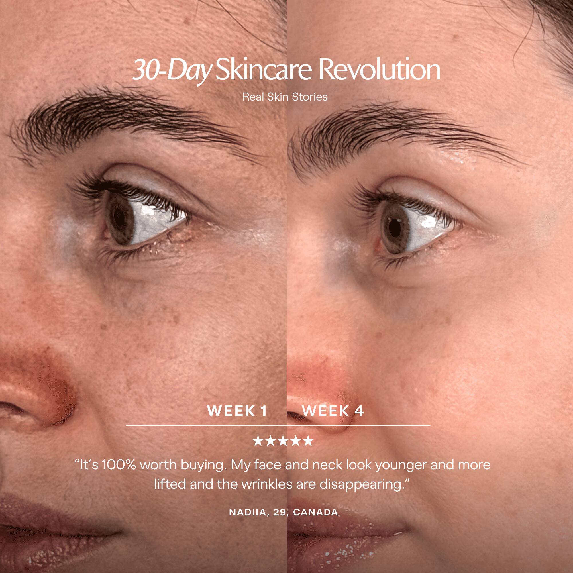 30-Day Skincare Revolution  
Real Skin Stories

WEEK 1  
WEEK 4

"It's 100% worth buying. My face and neck look younger and more lifted and the wrinkles are disappearing."  
NADIIA, 29, CANADA