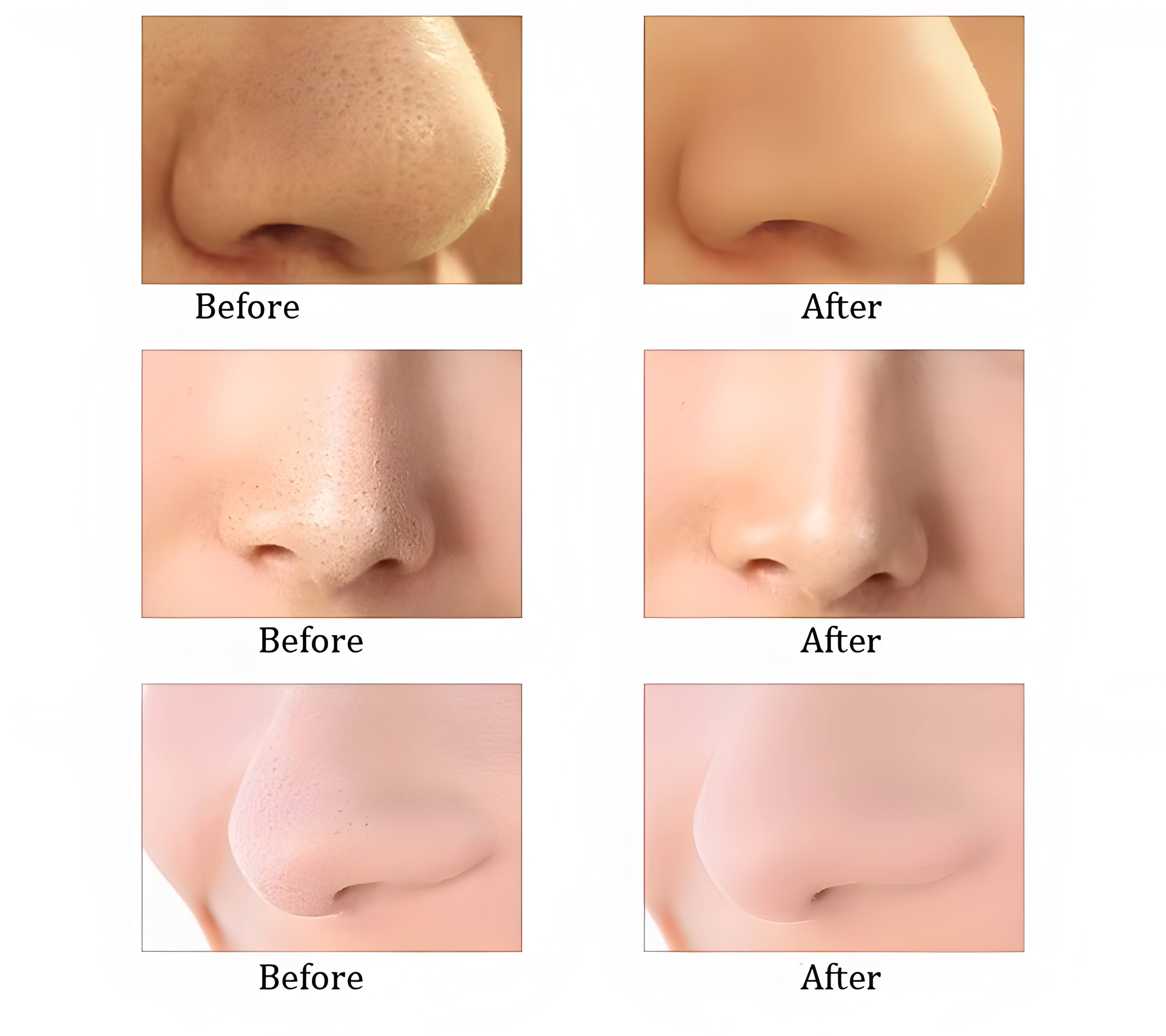 Before After  
Before After  
Before After