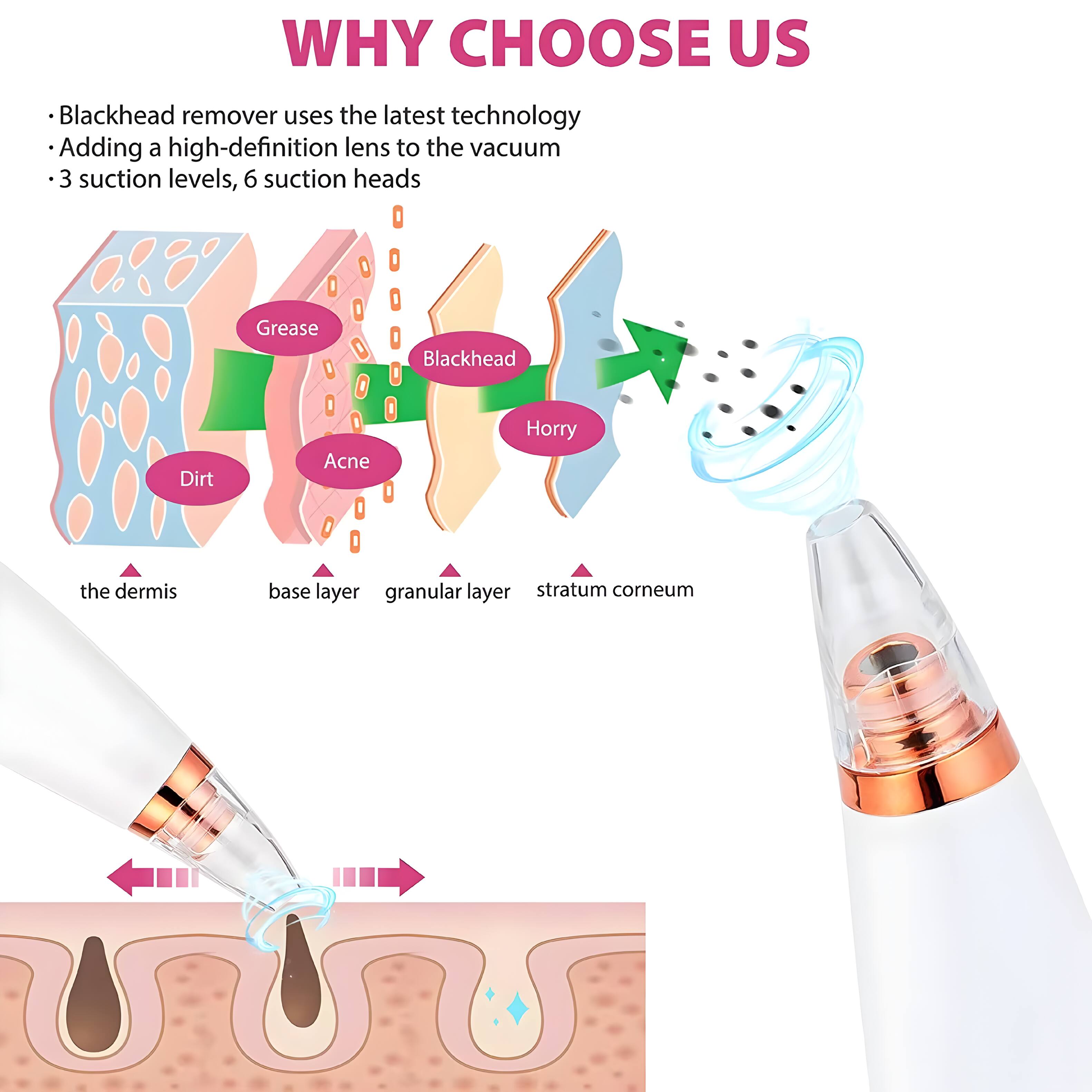 WHY CHOOSE US

- Blackhead remover uses the latest technology
- Adding a high-definition lens to the vacuum
- 3 suction levels, 6 suction heads

Grease
Dirt
Acne
Blackhead
Horry

the dermis
base layer
granular layer
stratum corneum