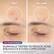 Before unretouched
After 4 weeks unretouched
Skin Clearing Treatment
CLINICALLY TESTED TO REDUCE ACNE, BREAKOUTS & EVEN COMPLEXION
*Results from 12-week clinical study with 59 subjects and 1x/day use in Skin Clearing treatment mode. Individual results may vary.