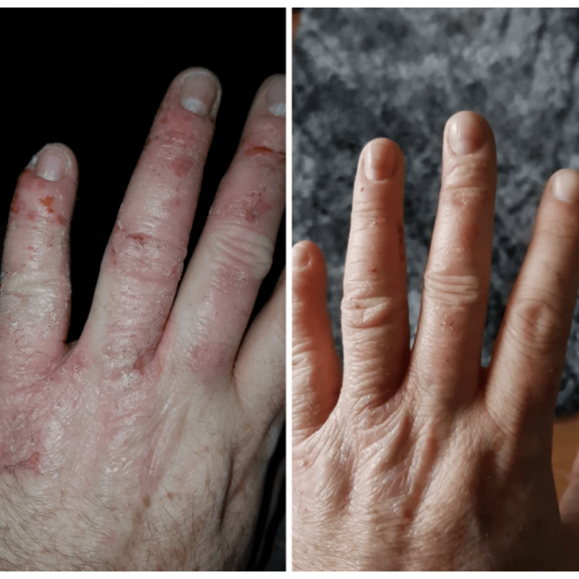 Alt View 3. Numiere - Numiere Hand Glow Anti-Aging Skincare LED Hand Mask - Nude.