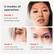 3 modes of operation
Mode 1
Full eye and forehead area
Mode 2
Lower eye area
Crows feet, under eyes
Mode 3
Upper eye area
11's, brows, lower forehead