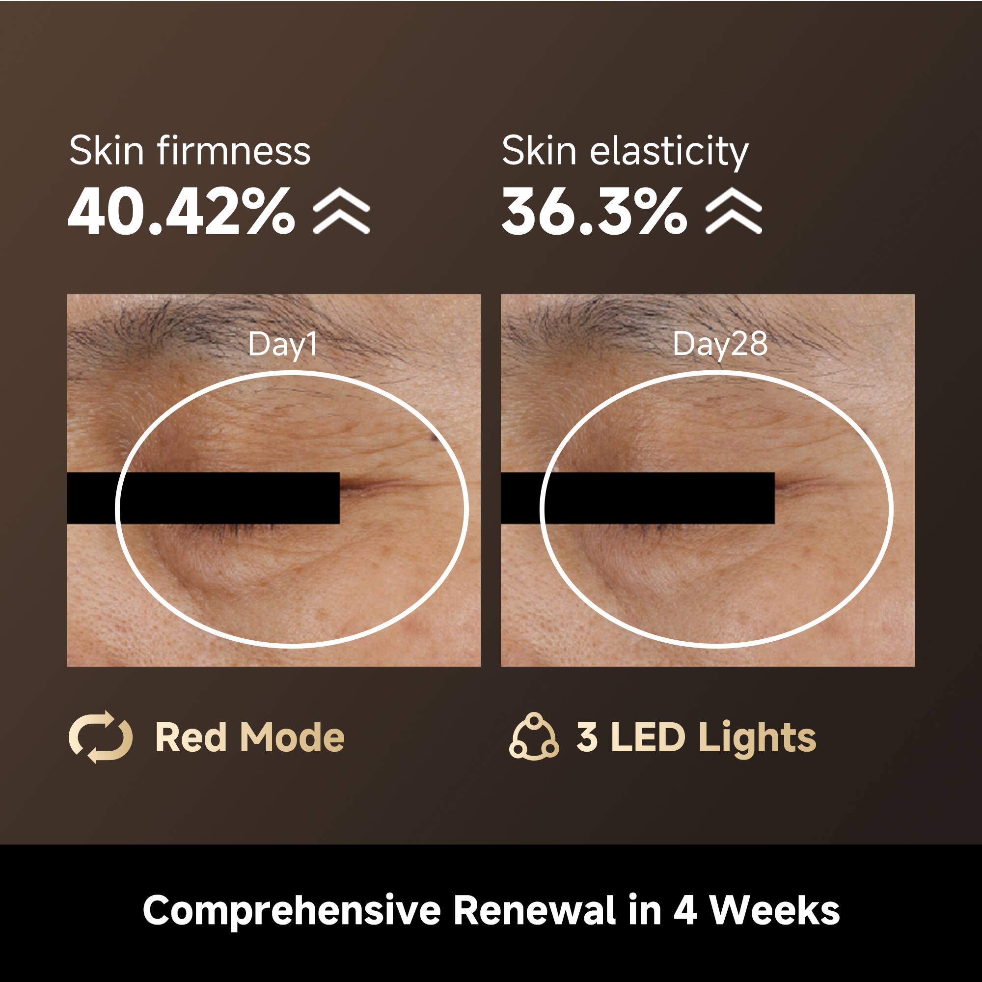 Skin firmness 40.42%  
Skin elasticity 36.3%  
Day1 Day28  
Red Mode  
3 LED Lights  
Comprehensive Renewal in 4 Weeks
