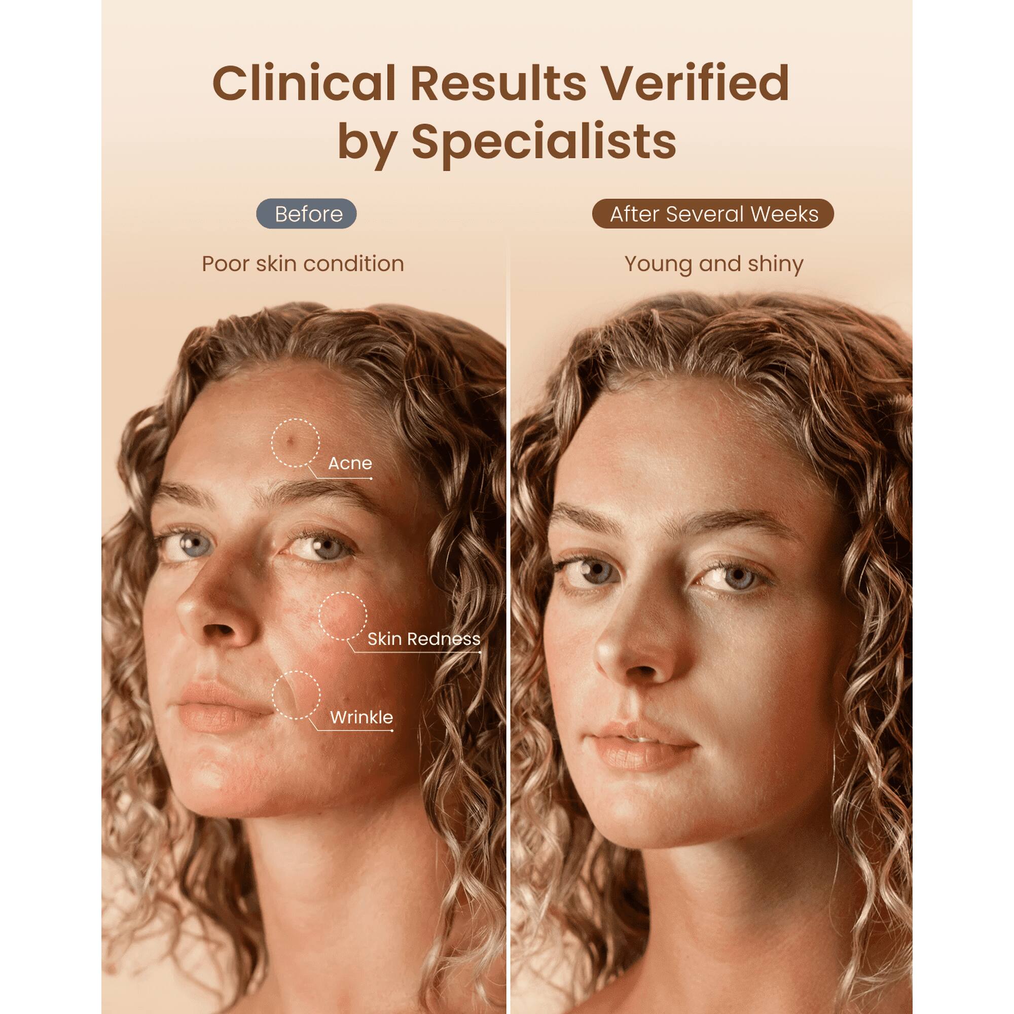 Clinical Results Verified by Specialists

Before
- Poor skin condition
- Acne
- Skin Redness
- Wrinkle

After Several Weeks
- Young and shiny
