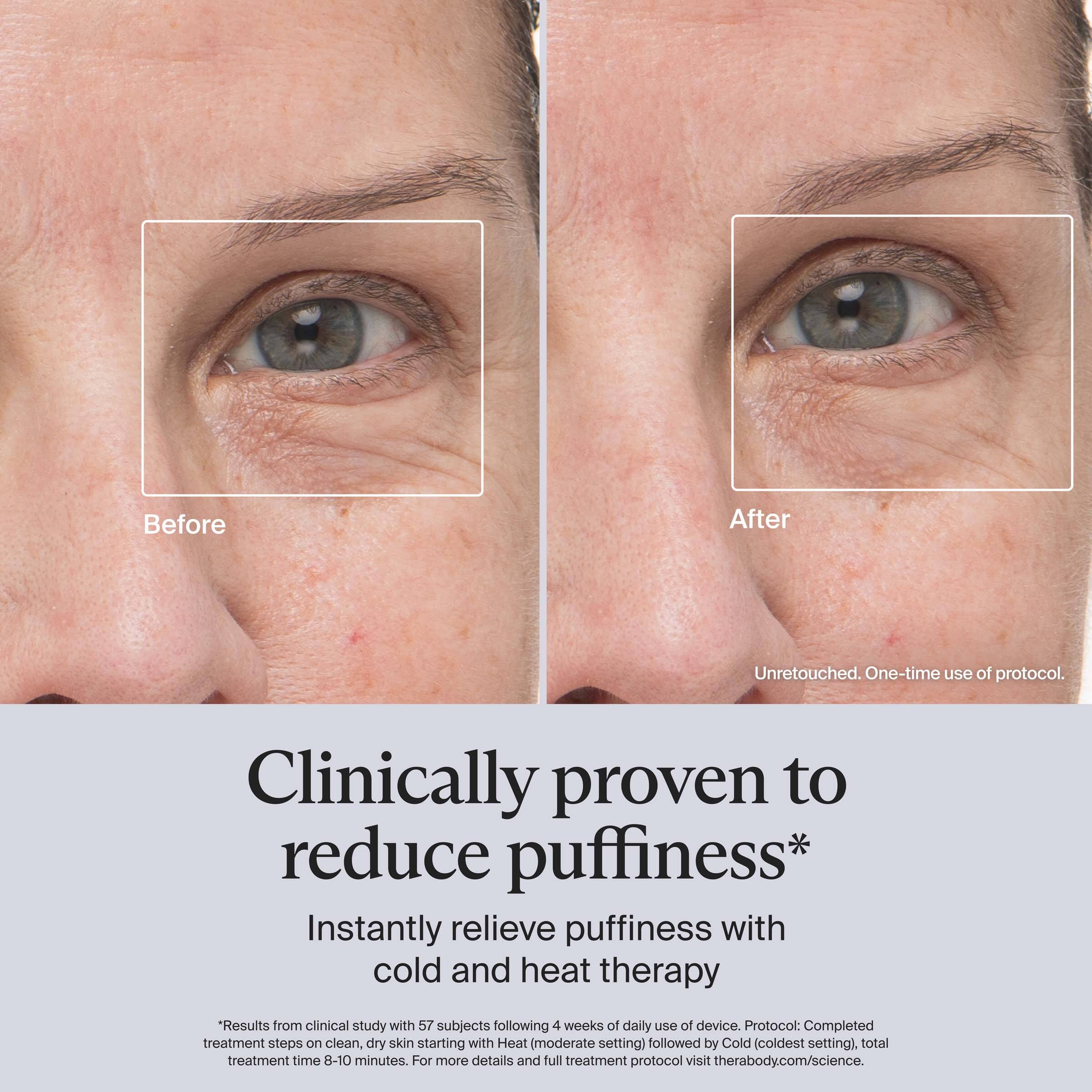 Before After Unretouched. One-time use of protocol.

Clinically proven to reduce puffiness*

Instantly relieve puffiness with cold and heat therapy

*Results from clinical study with 57 subjects following 4 weeks of daily use of device. Protocol: Completed treatment steps on clean, dry skin starting with Heat (moderate setting) followed by Cold (coldest setting), total treatment time 8-10 minutes. For more details and full treatment protocol visit therabody.com/science.