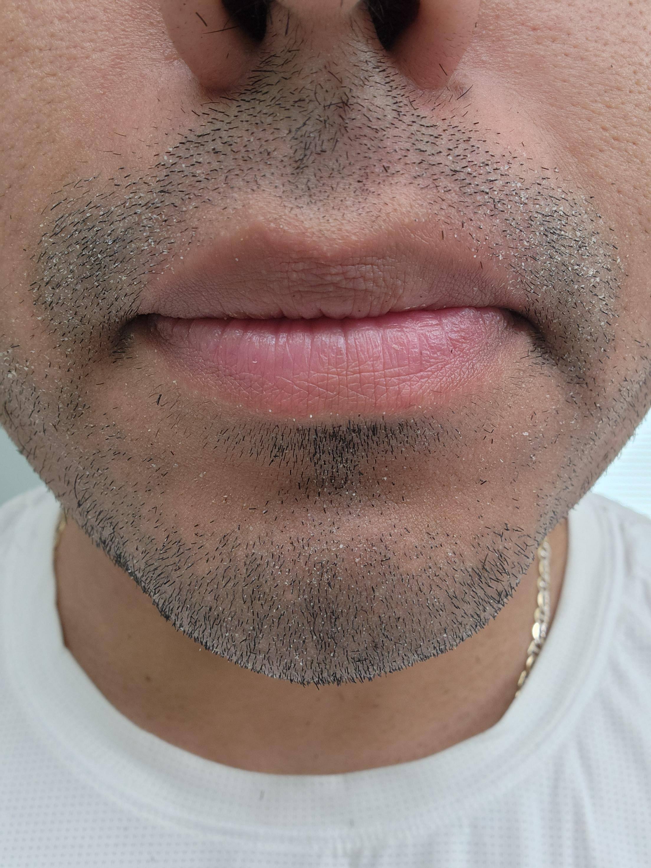 Left Side is A-1 Setting. Right Side is A-2 Setting, click to load a larger version