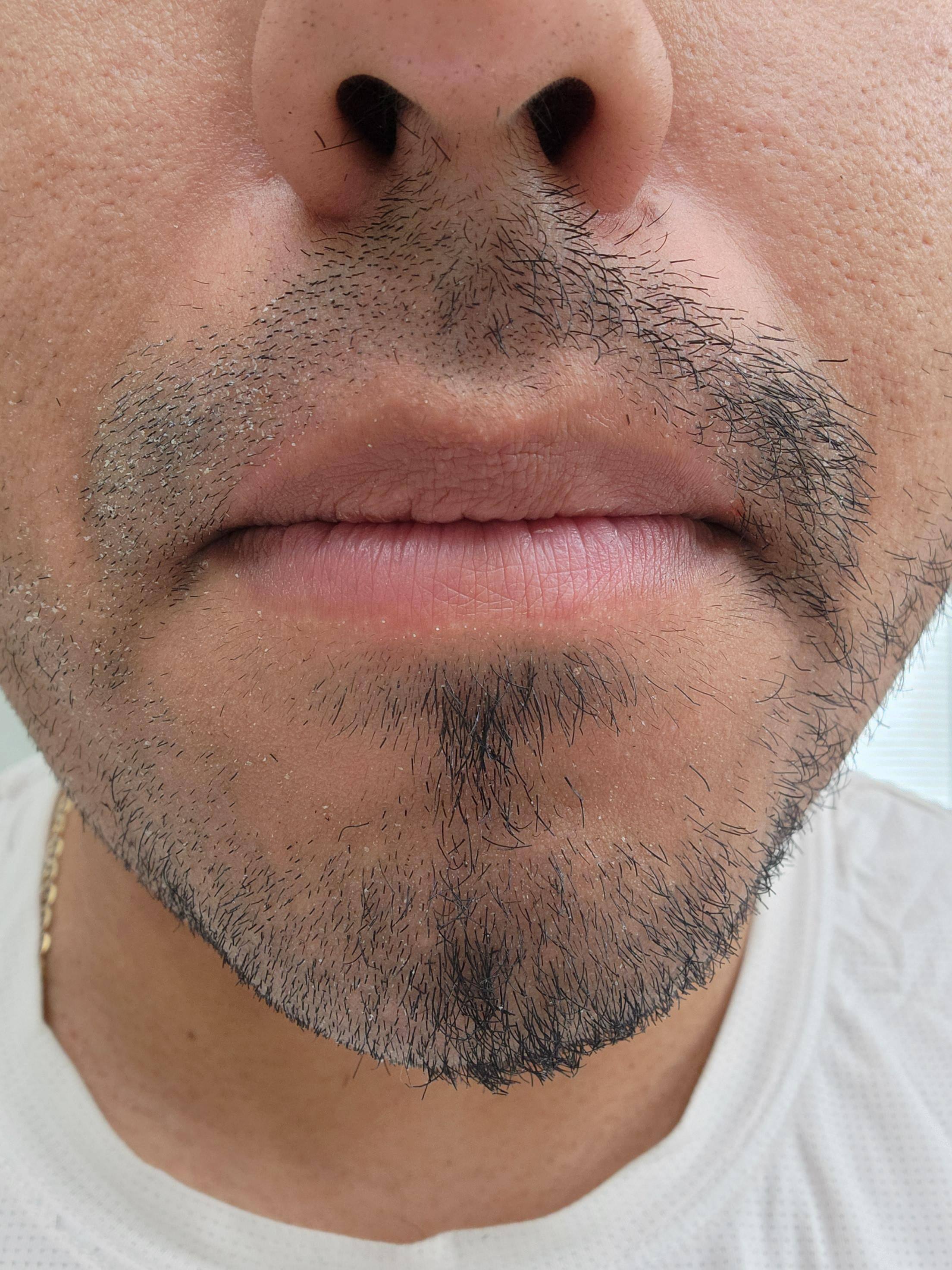 Left side is A-2 Setting. Right side is A-3 Setting, click to load a larger version