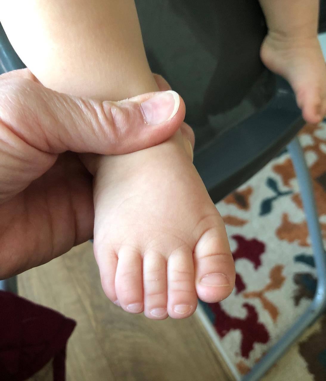 Baby Foot, click to load a larger version