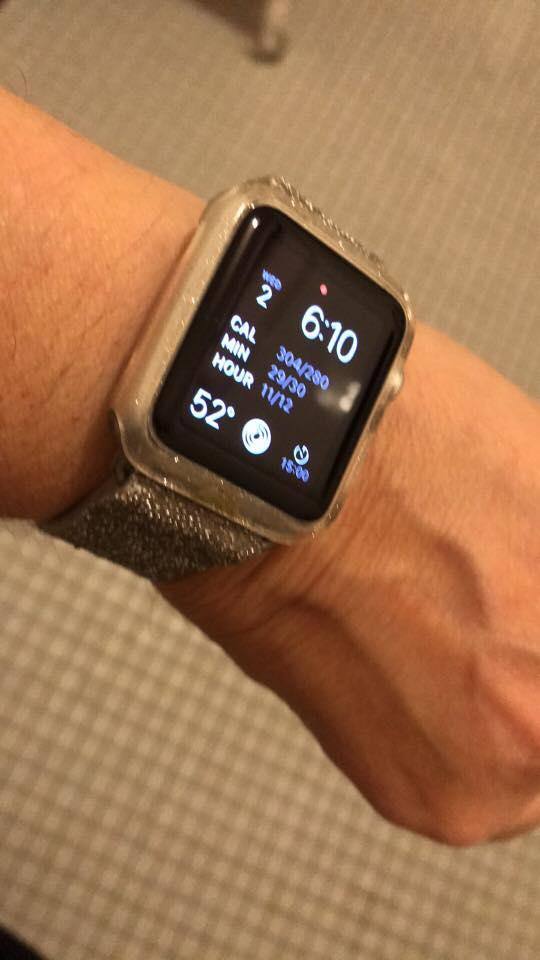 Casmate Apple Watch Case and Band, click to load a larger version