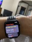 Best Buy: Apple Watch Series 8 (GPS) 41mm Aluminum Case with