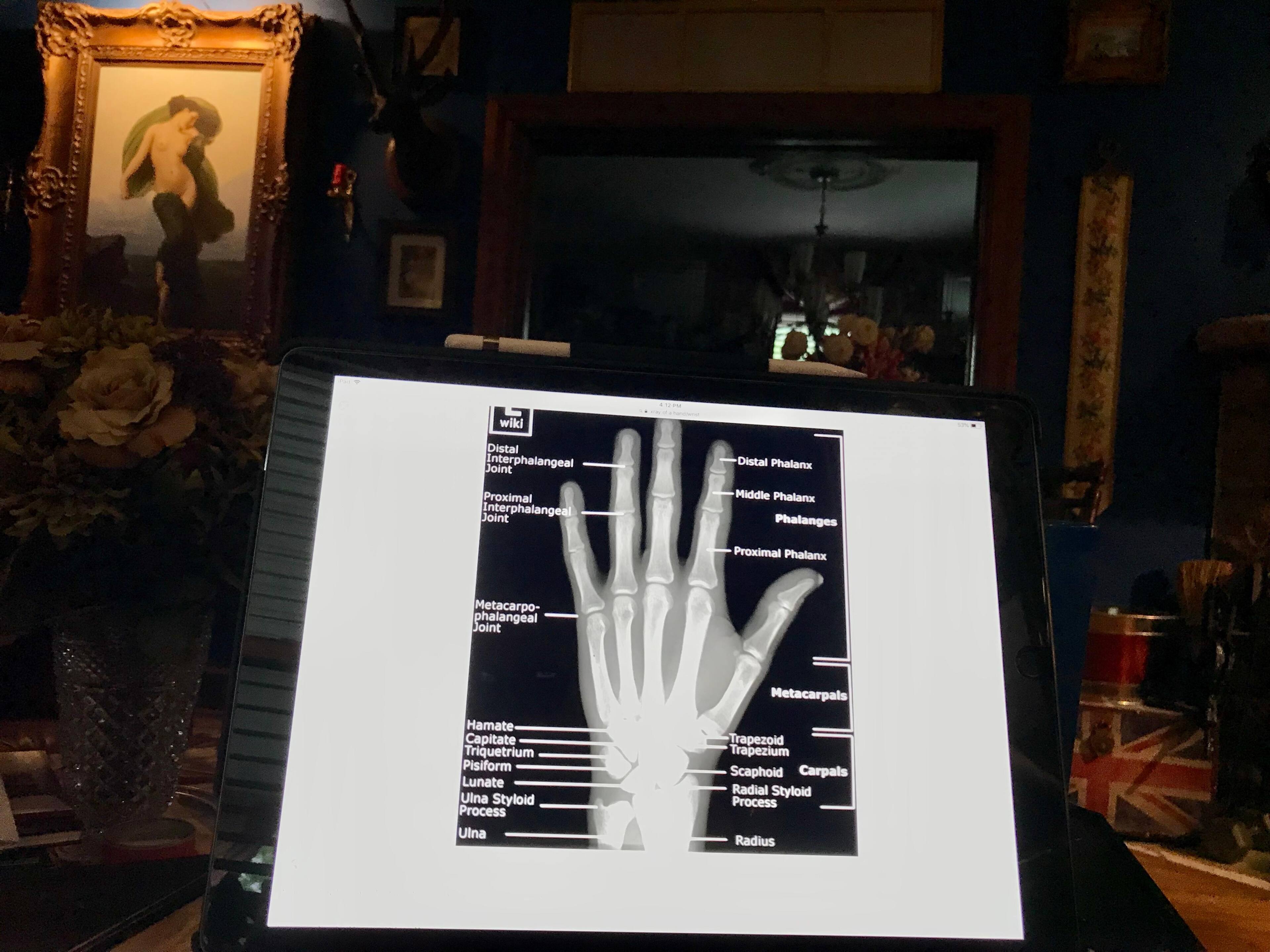 Customer provided image, click to load a larger version