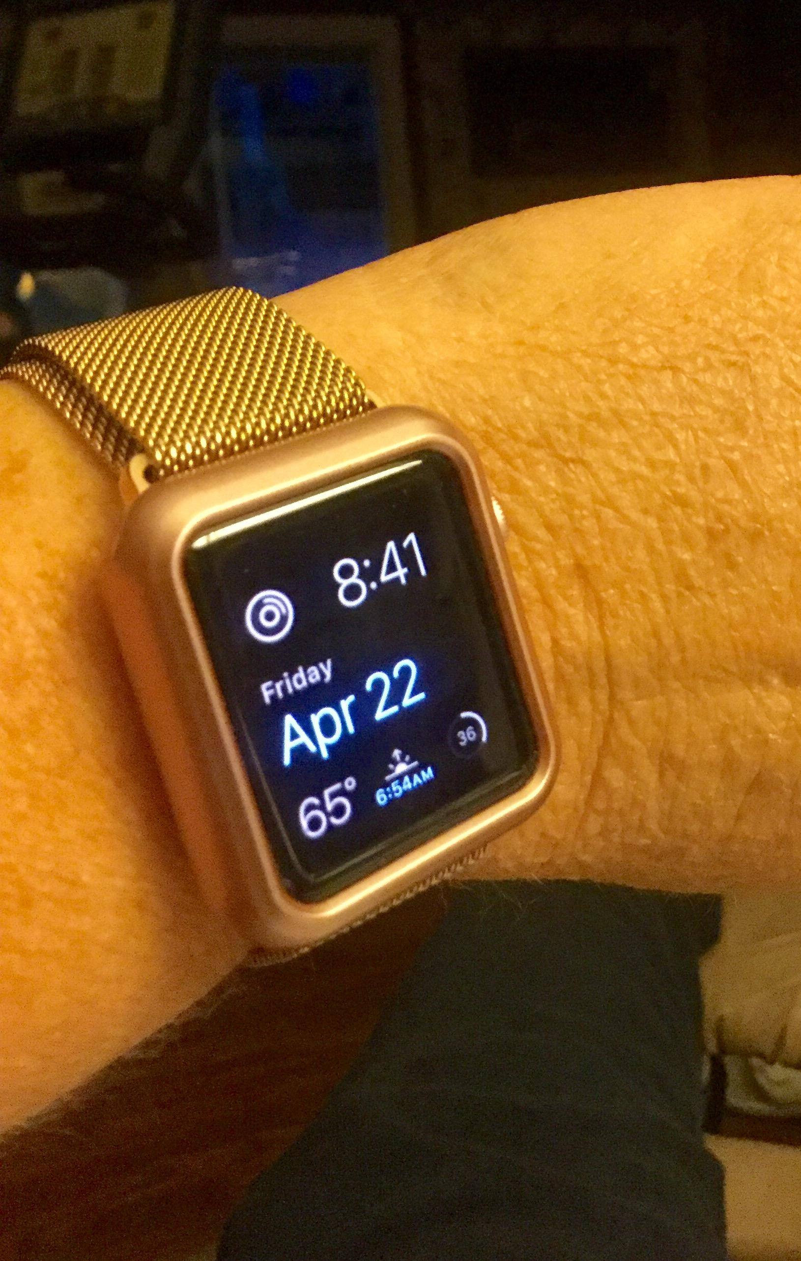 My rose gold band and bumper guard, click to load a larger version