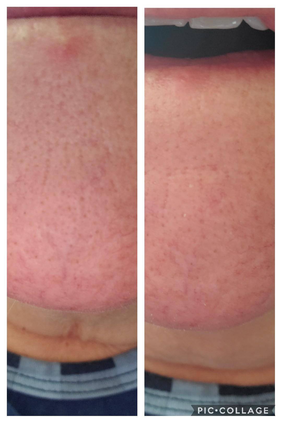 Left before/Right after exfoliating, click to load a larger version