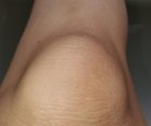 Knee hairs after., click to load a larger version