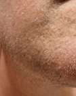 trim length with no guards, click to load a larger version
