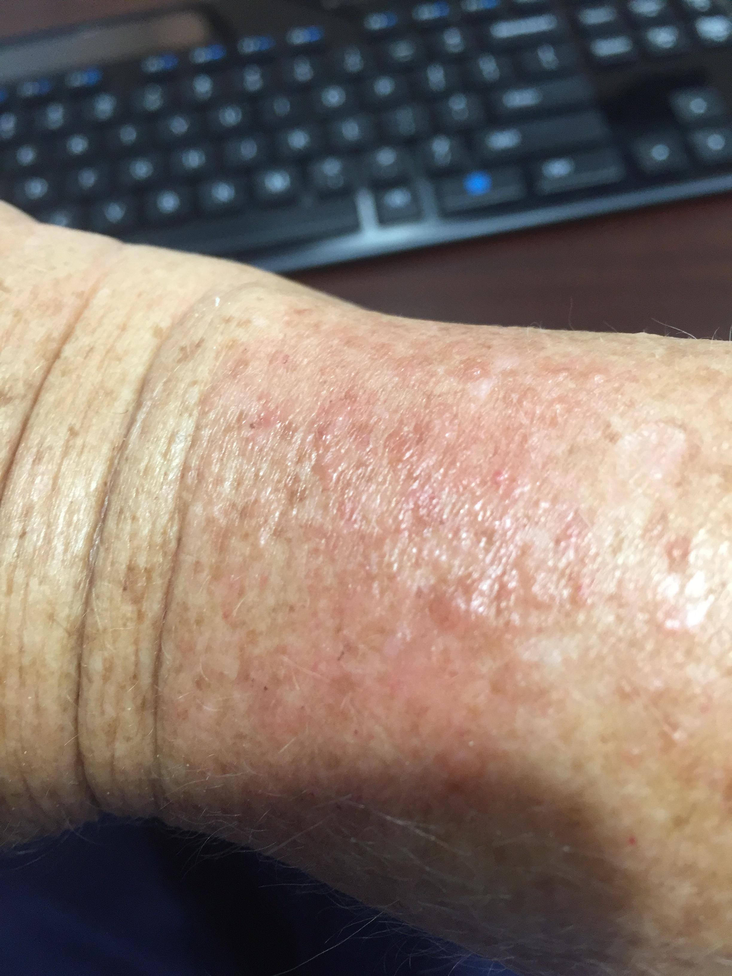 Ouch!.,, click to load a larger version