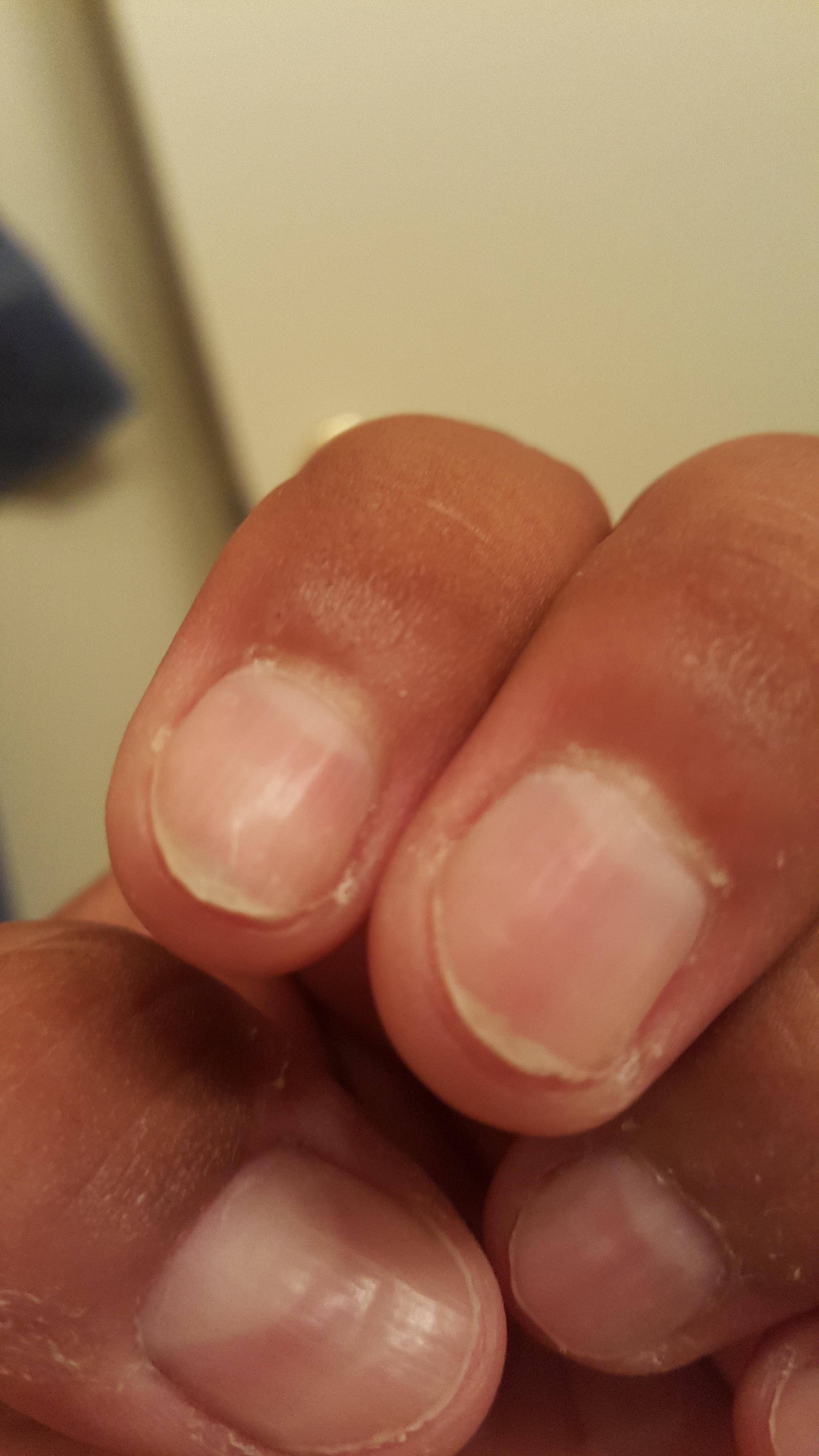 Nails will get beat up taking off the magnet, click to load a larger version