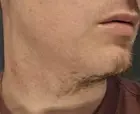 After 5 mins of shaving, the results were good but still needed more cleanup to get the perfect shave.  The closeness was unreal for an electric shaver, with no cuts even after multiple passes., click to load a larger version